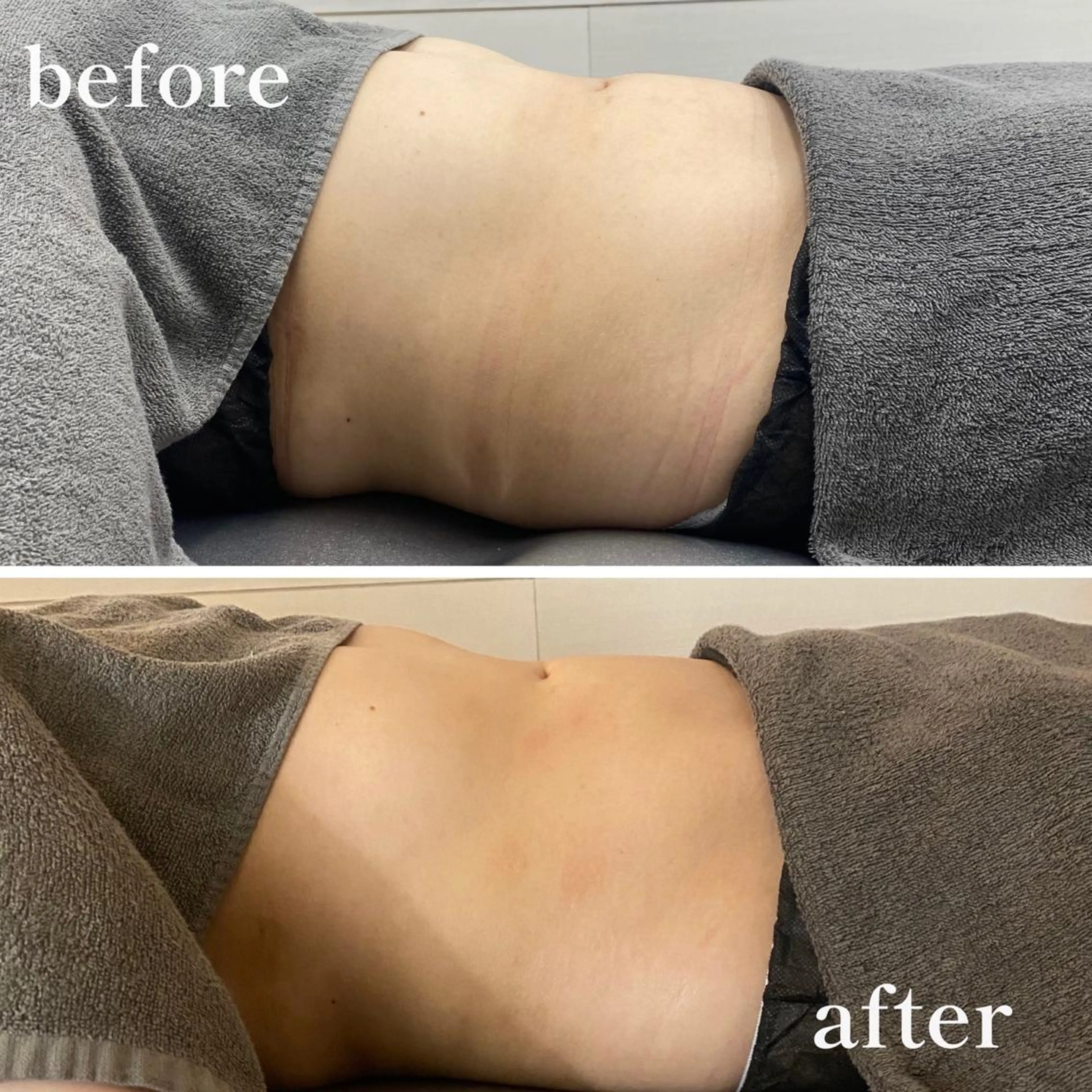 温活未病ケアサロン CoQのエステ・リラクイメージ