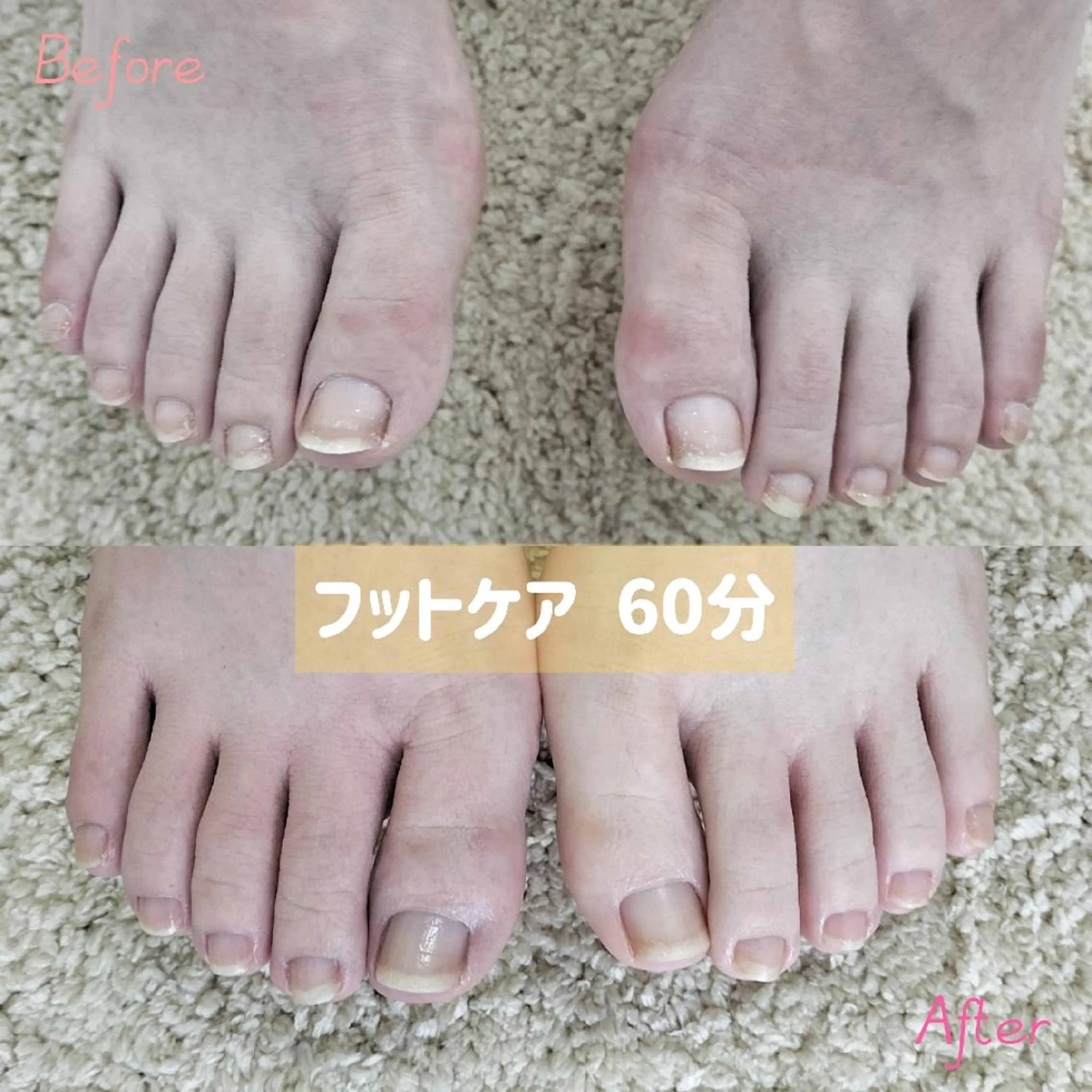 ネイル フットネイル 小川 アリサのマツエク・マツパデザイン