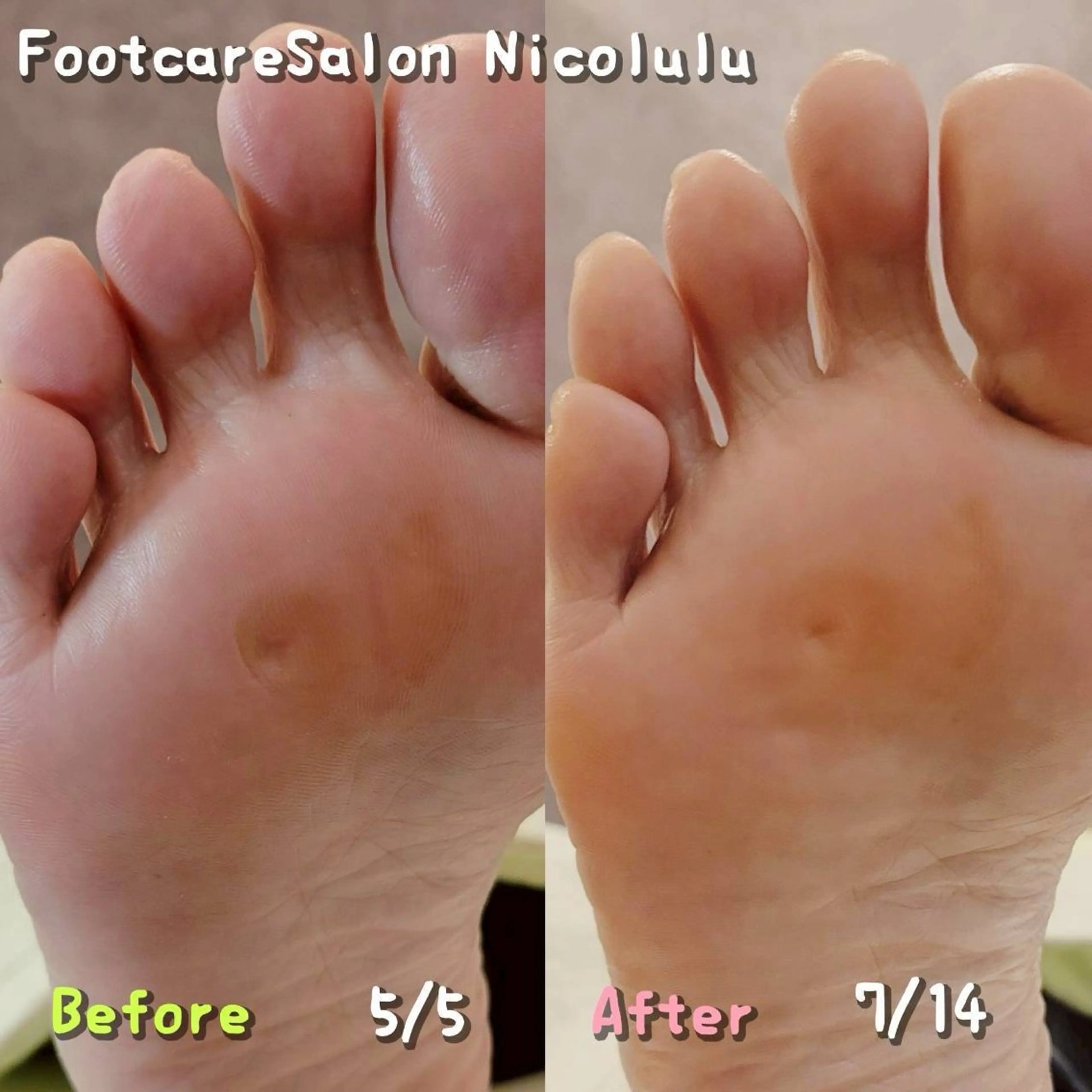 リラク 足トラブル専門 ニコルル金沢のエステ・リラクイメージ