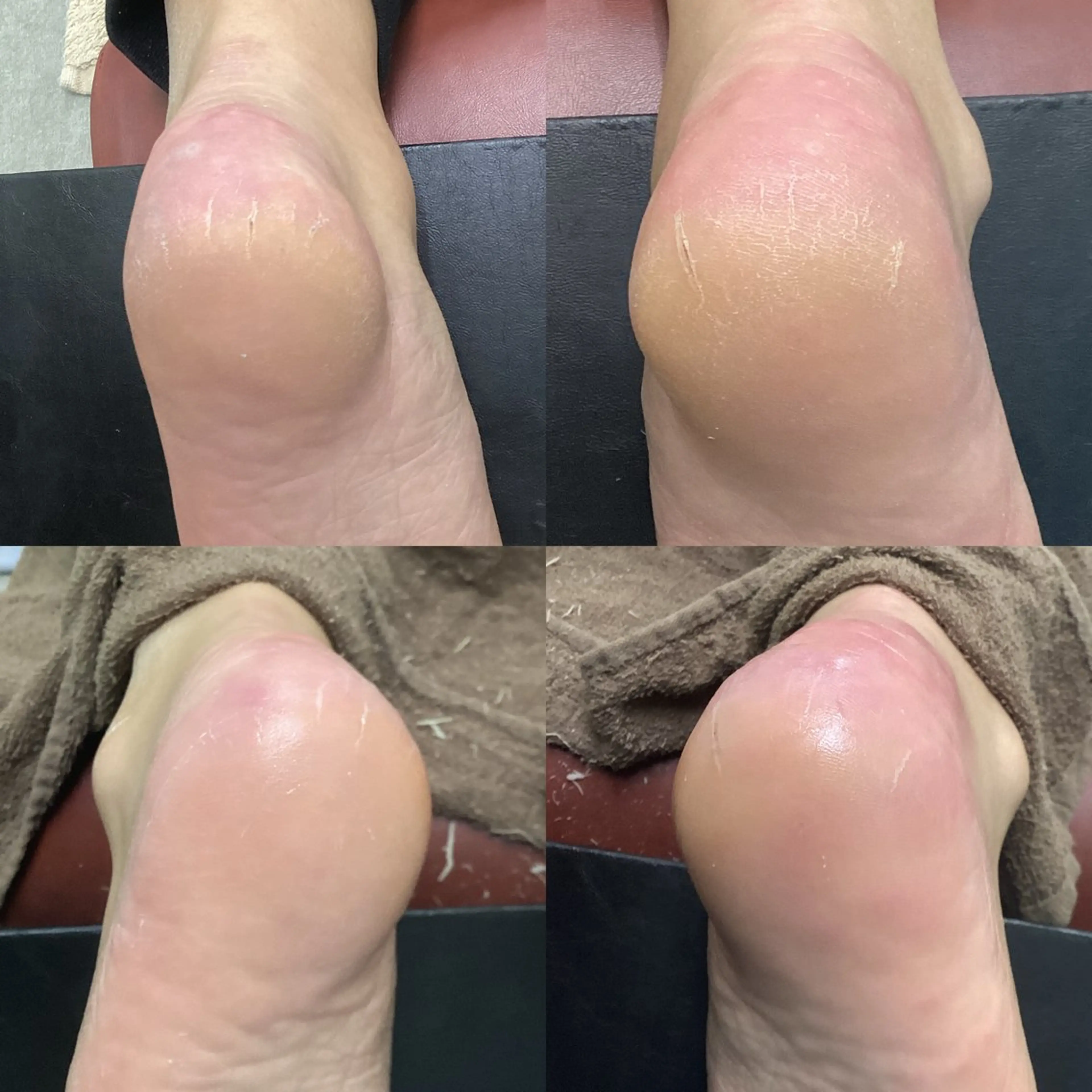 リラク ヒューマン 鍼灸接骨院所属・リラク/ヘッドスパ/ 足裏ケア/蛭川栞のエステ・リラクイメージ