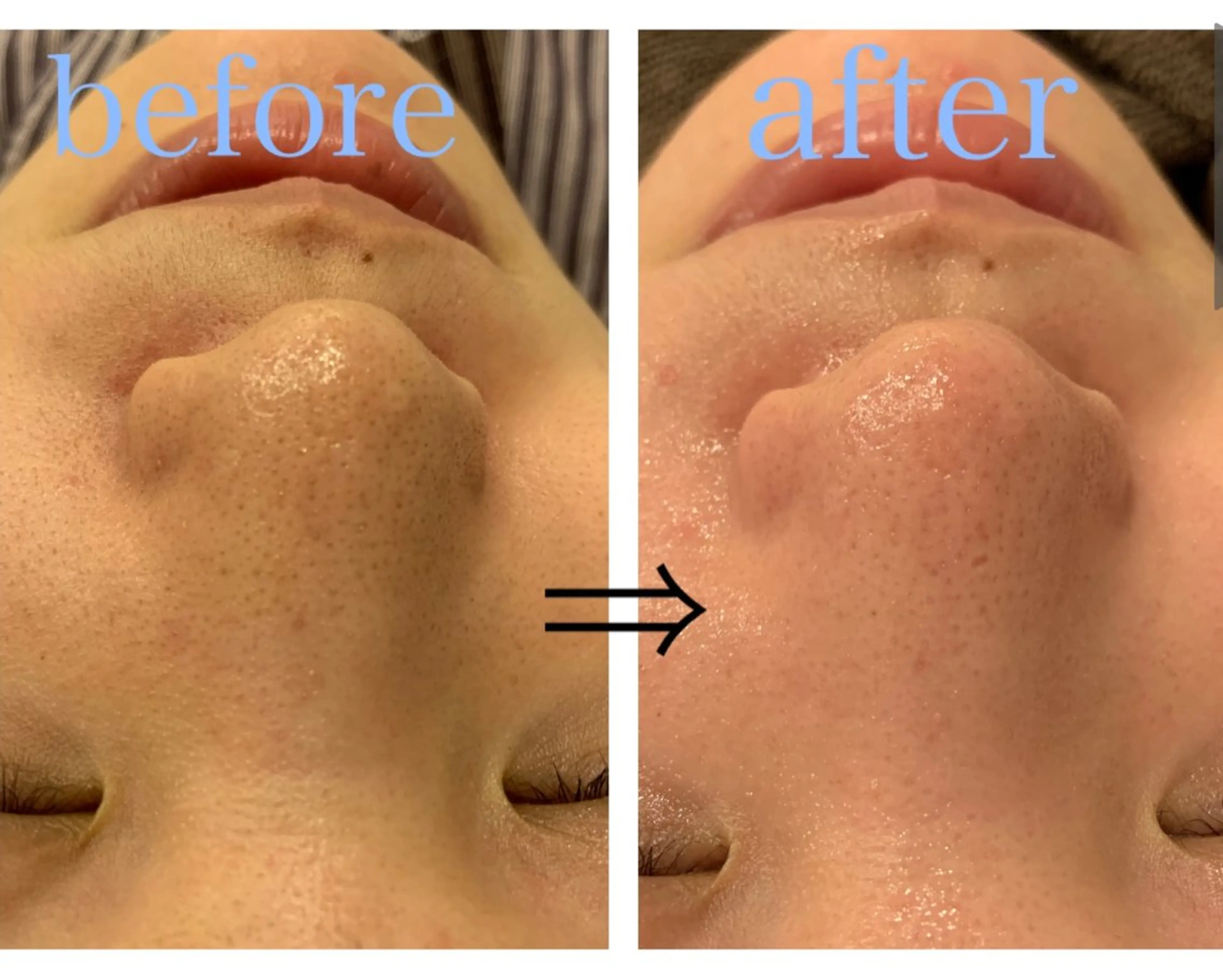 エステ リジュベ所属・Rejuve ﾘｼﾞｭﾍﾞのエステ・リラクイメージ