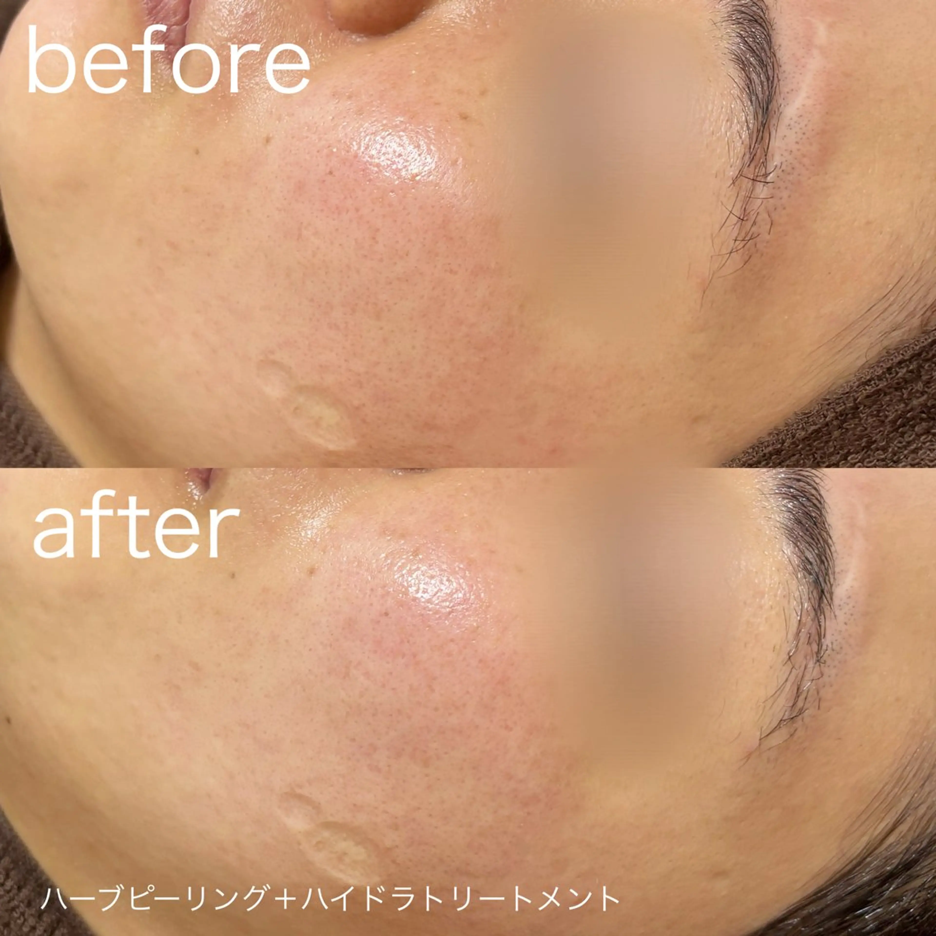 その他 lulularico Yuのエステ・リラクイメージ