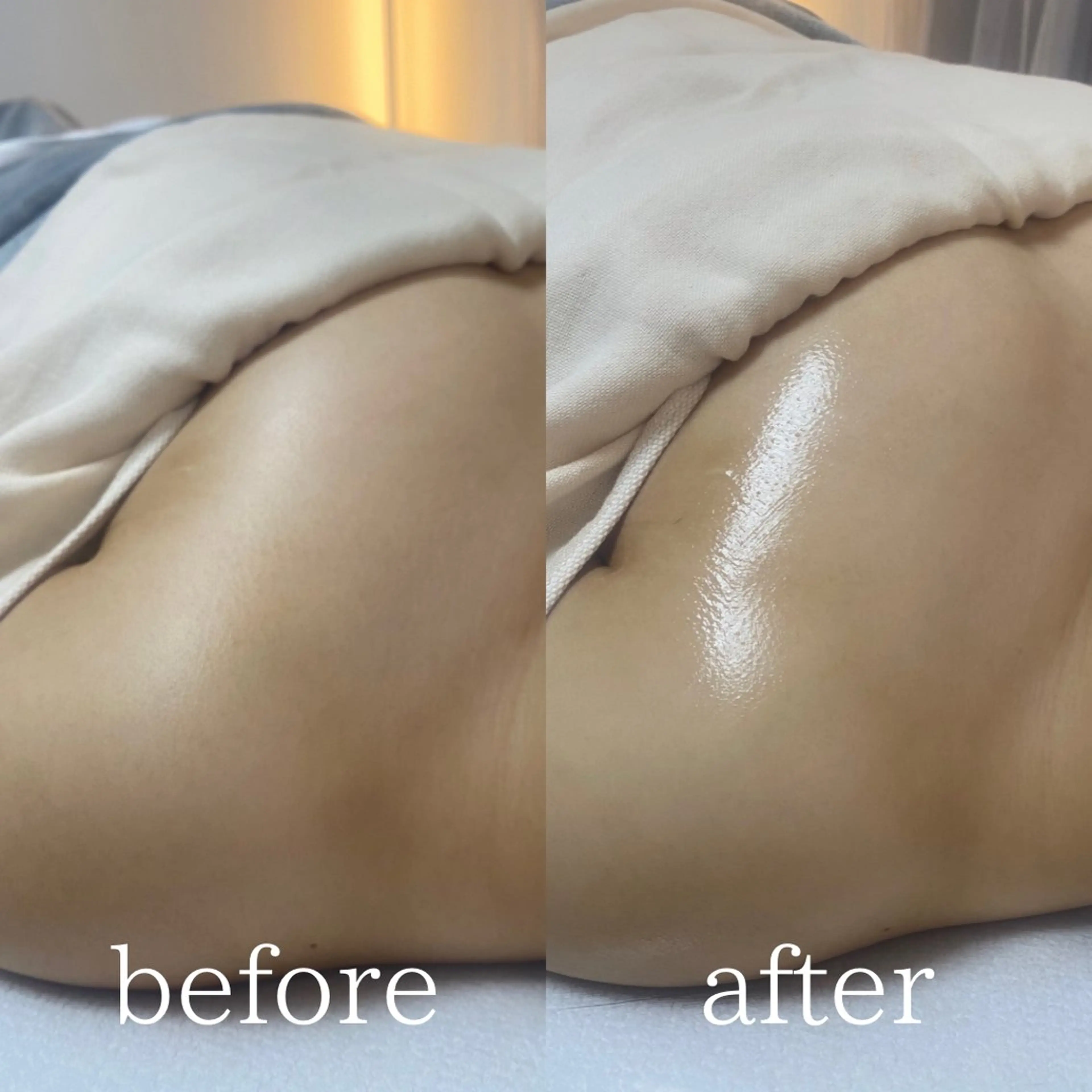 エステ AKALA hitomiのエステ・リラクイメージ