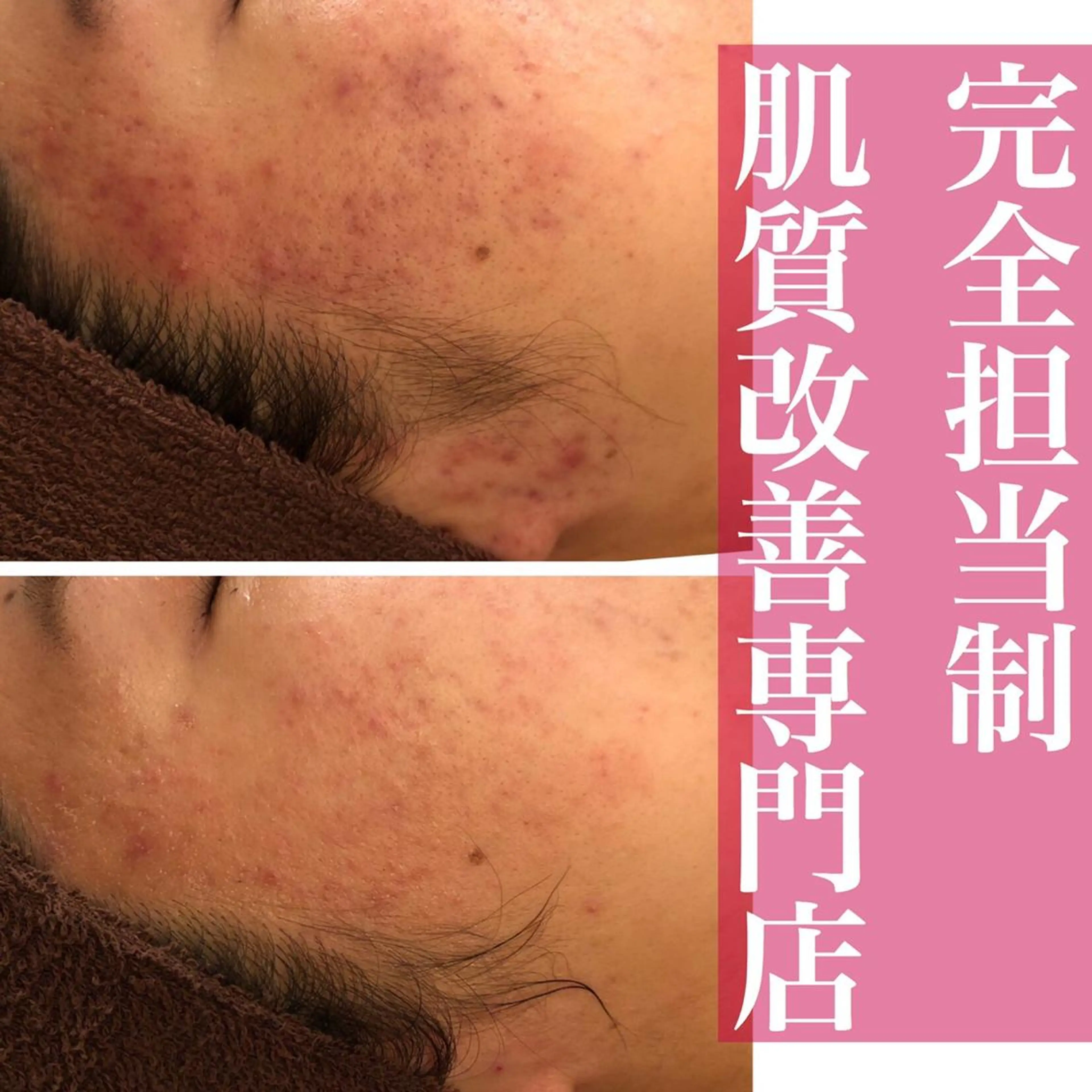 ミディアム カラー パーマ ヘアアレンジ メンズ キッズ ネイル マツエク・マツパ エステ リラク ニキビ・肌質改善専門 ♡人生が変わるサロンのエステ・リラクイメージ