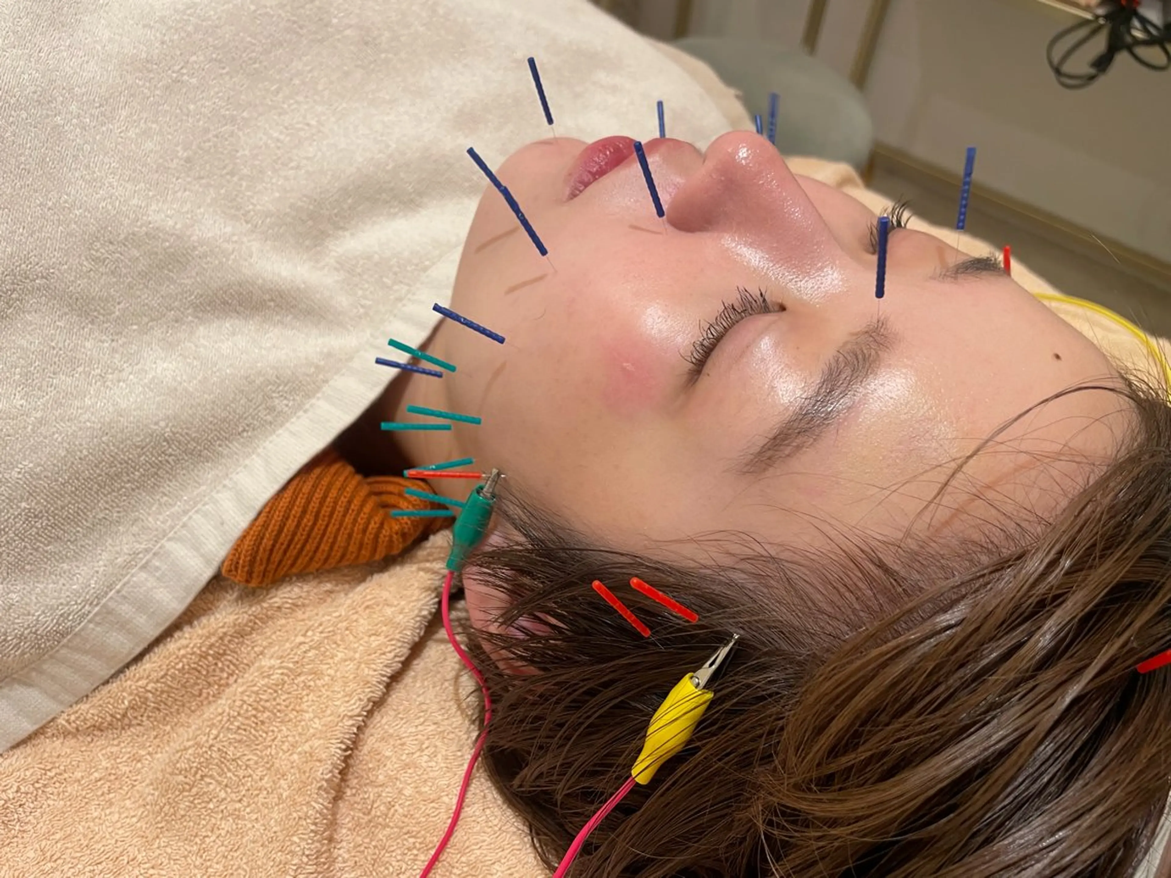 エステ リラク 美容鍼サロンメゾンブランシェ所属・🌸美容鍼サロン🌸 メゾンブランシェ🌈のエステ・リラクイメージ