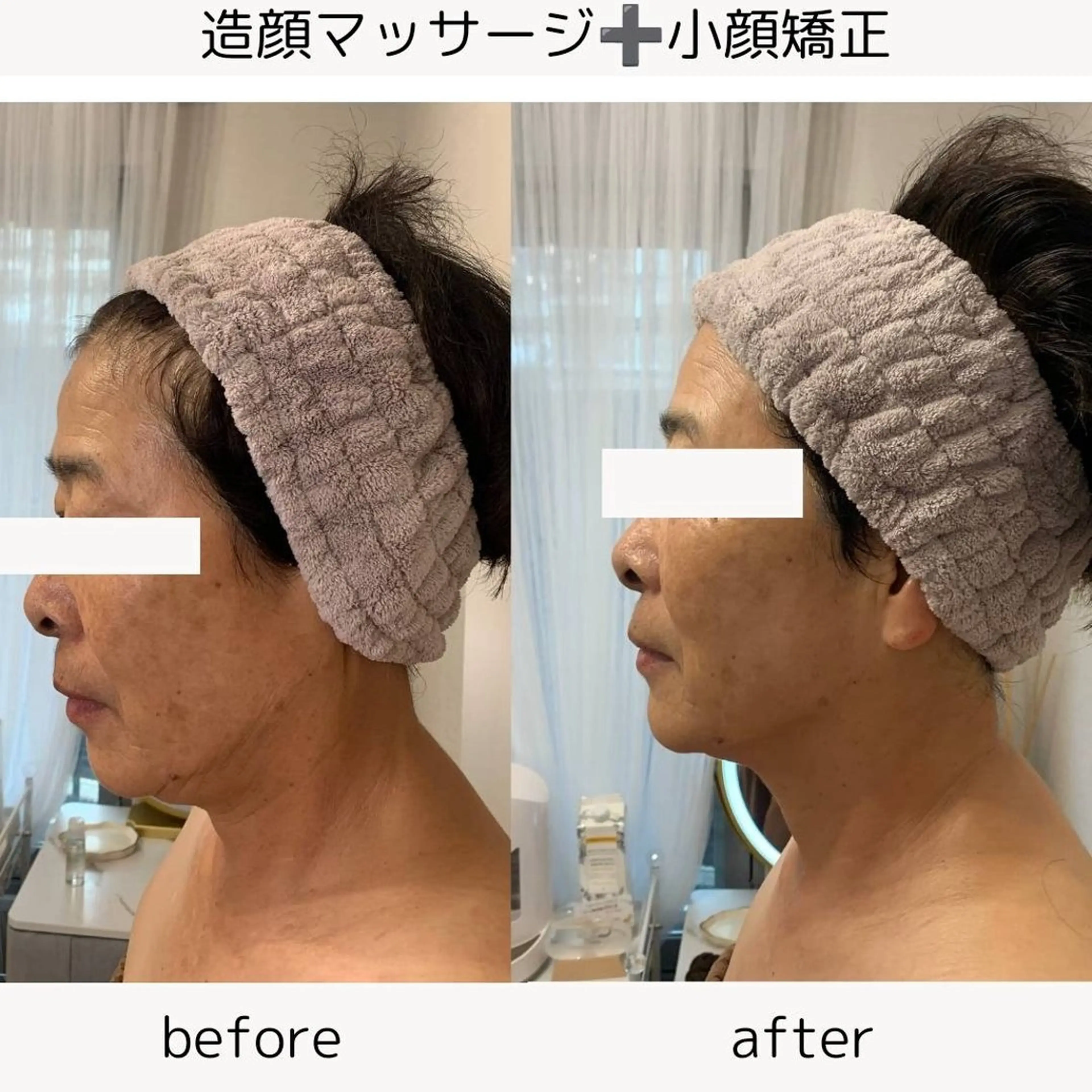 小顔矯正☀︎バスト ☀︎ハルのエステ・リラクイメージ