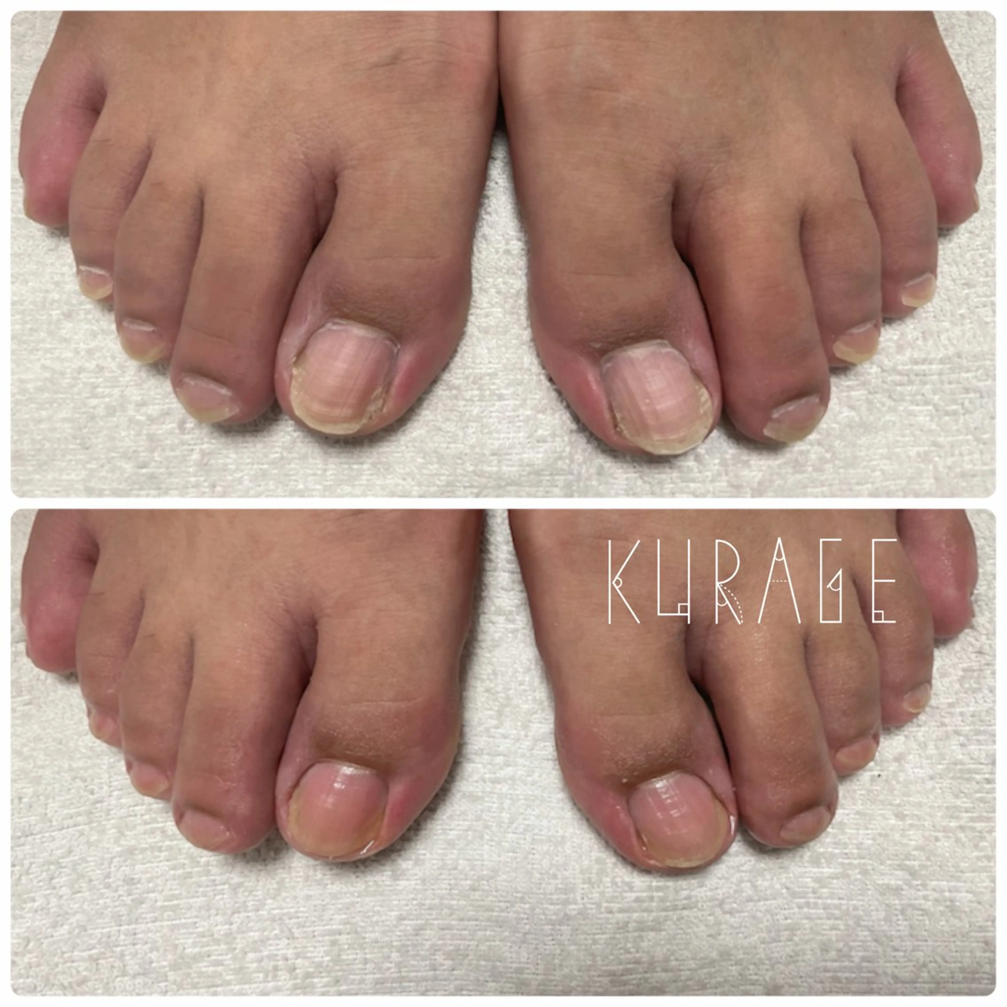 ネイル その他(ネイル) private salon 海月のネイルデザイン