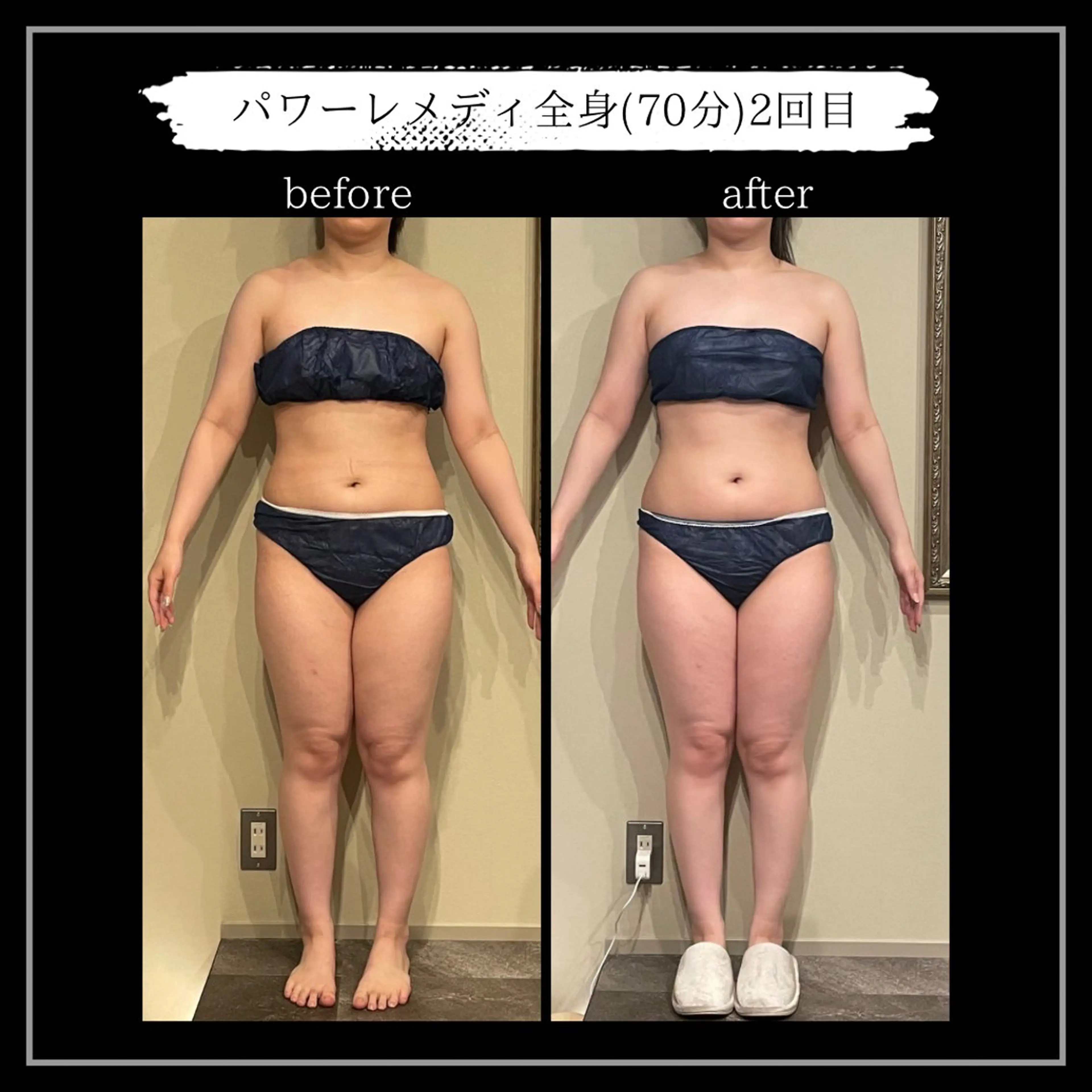 オフ:オン所属・オフ:オン 全身筋膜マッサージのエステ・リラクイメージ