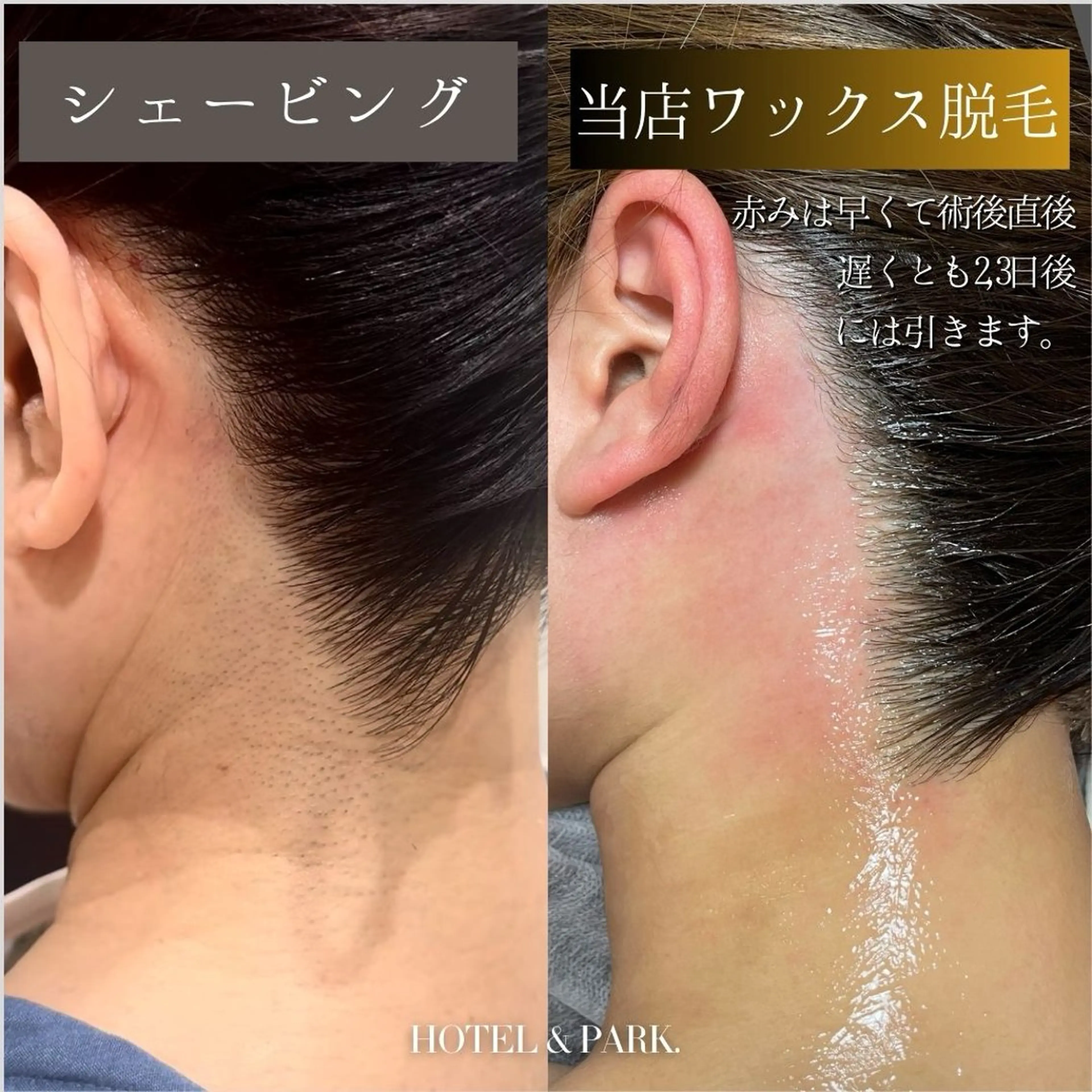 HOTEL&PARK . ワックス脱毛のエステ・リラクイメージ
