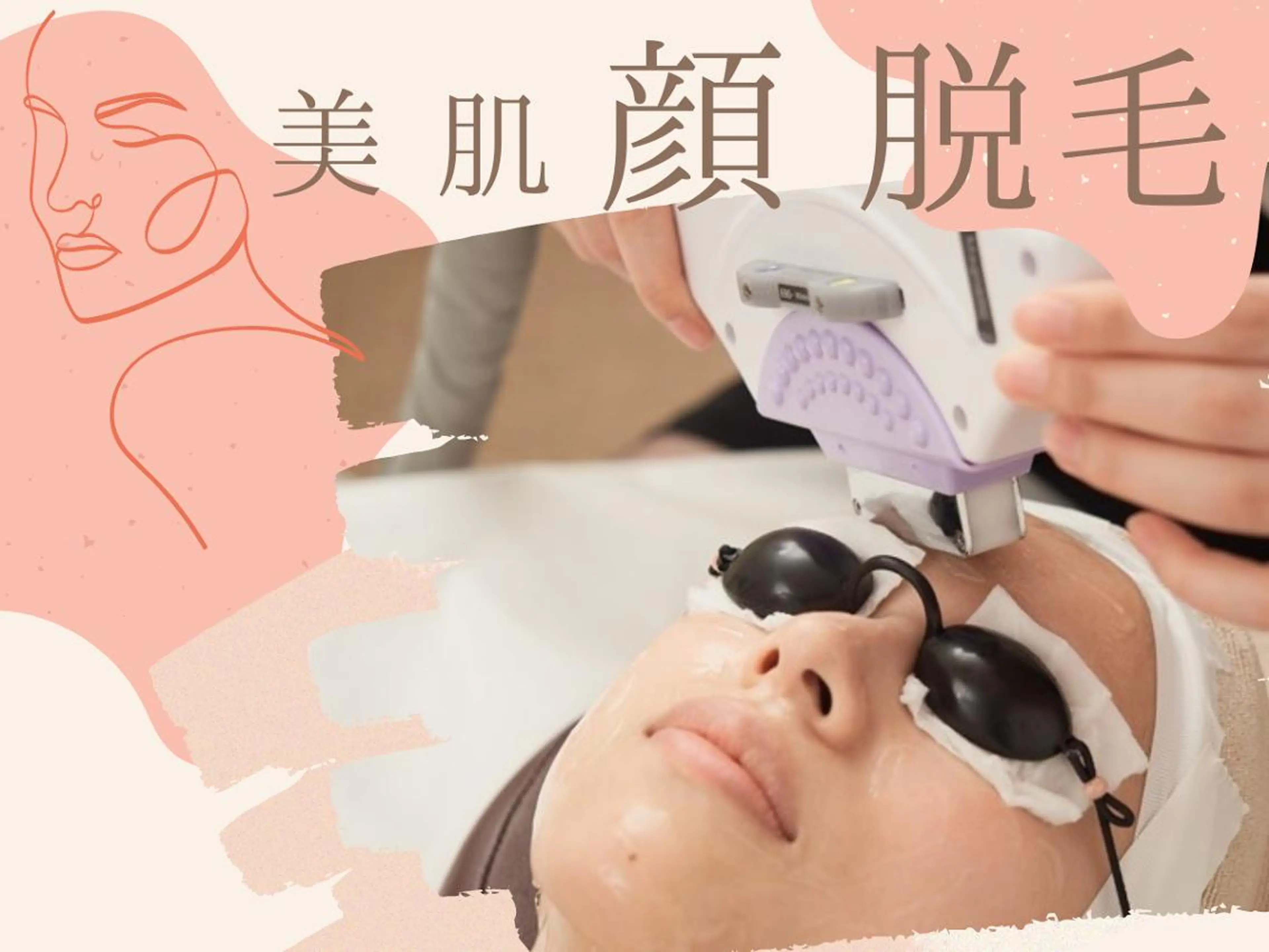 【ミニモ限定価格‼︎】美肌お顔脱毛♪の写真