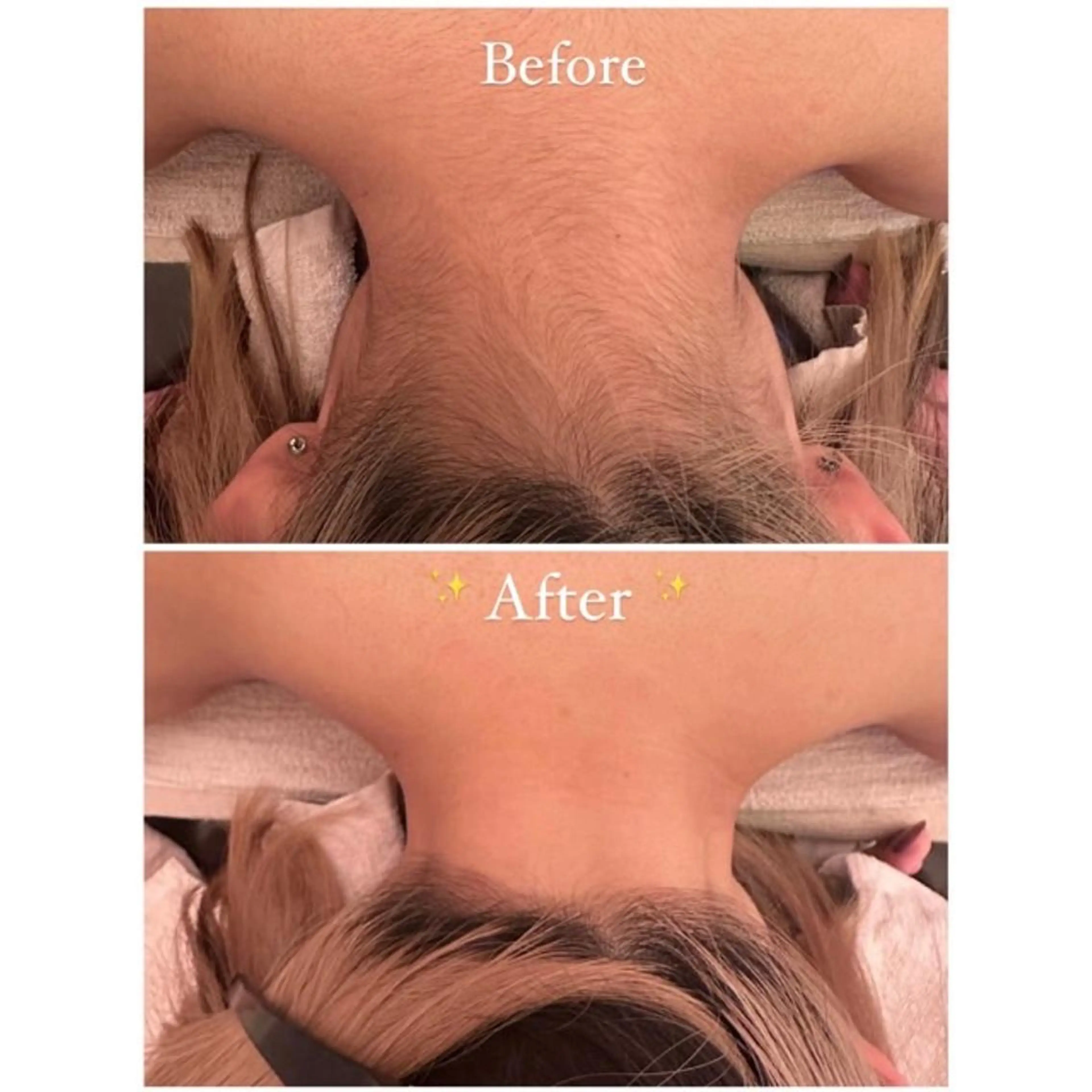 脱毛 鈴木 愛花のエステ・リラクイメージ