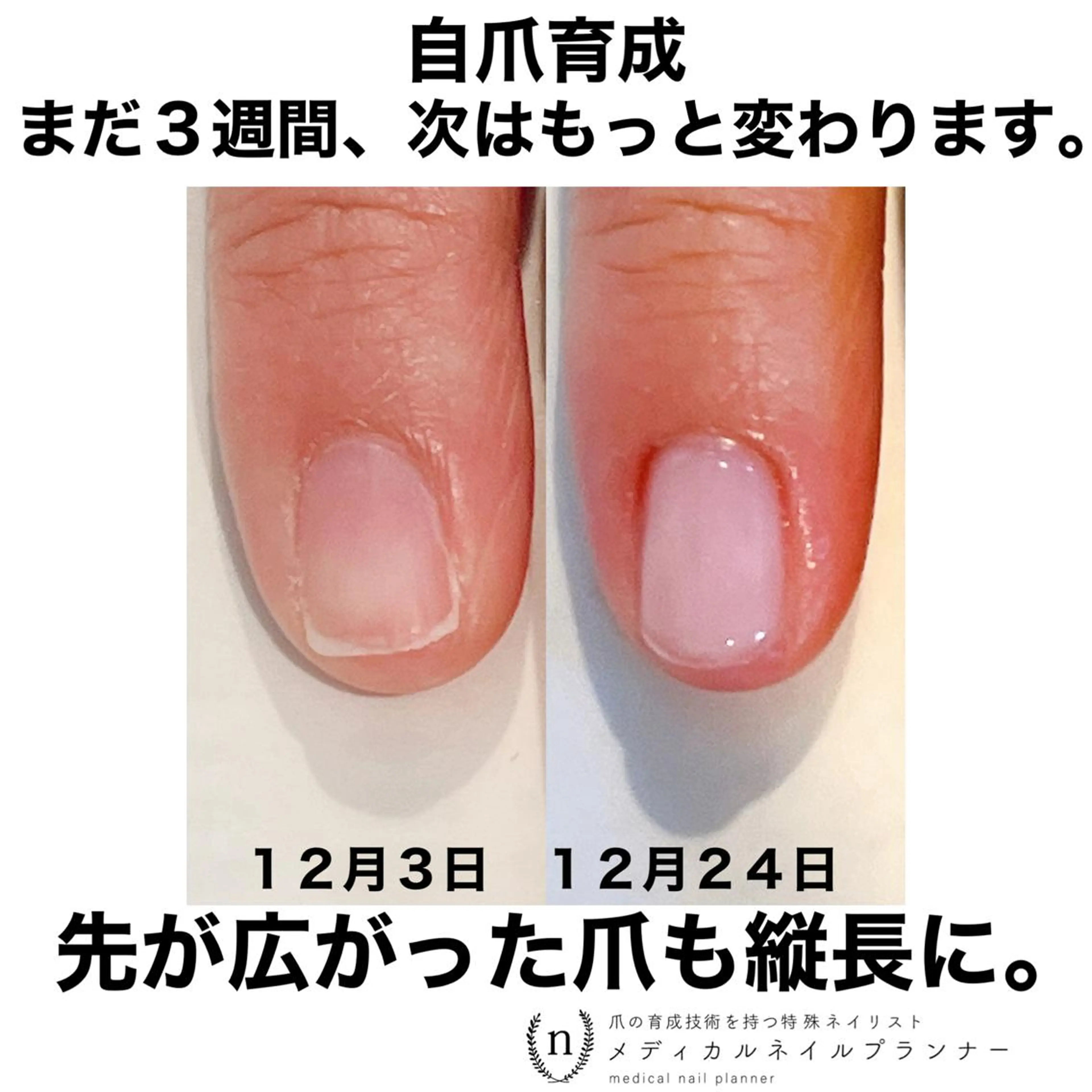 ネイル NAIL SALON ｔｏｇｇｙのネイルデザイン