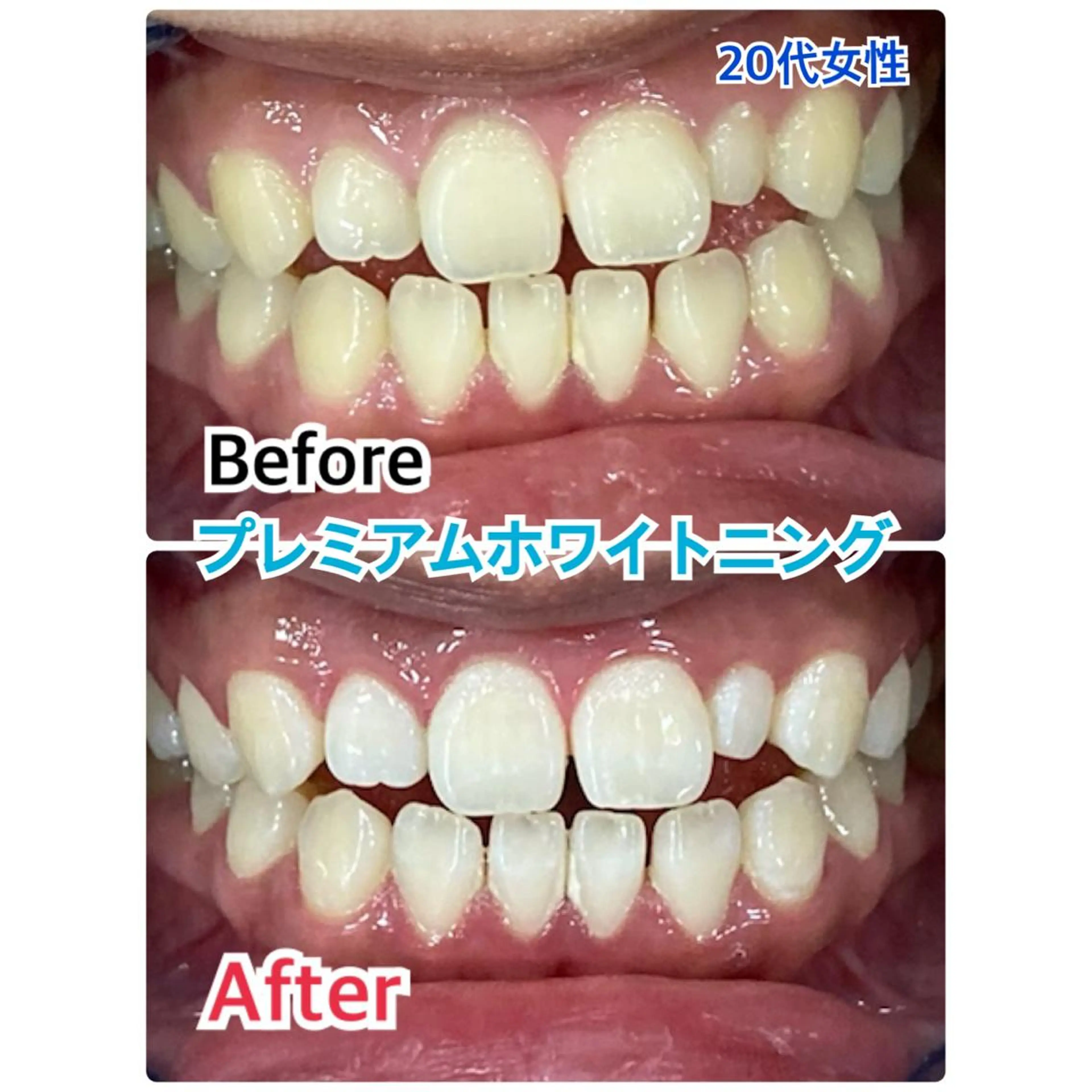 プラチナムビューティー柏所属・【歯科提携】柏ホワイ トニングスタイルのその他イメージ