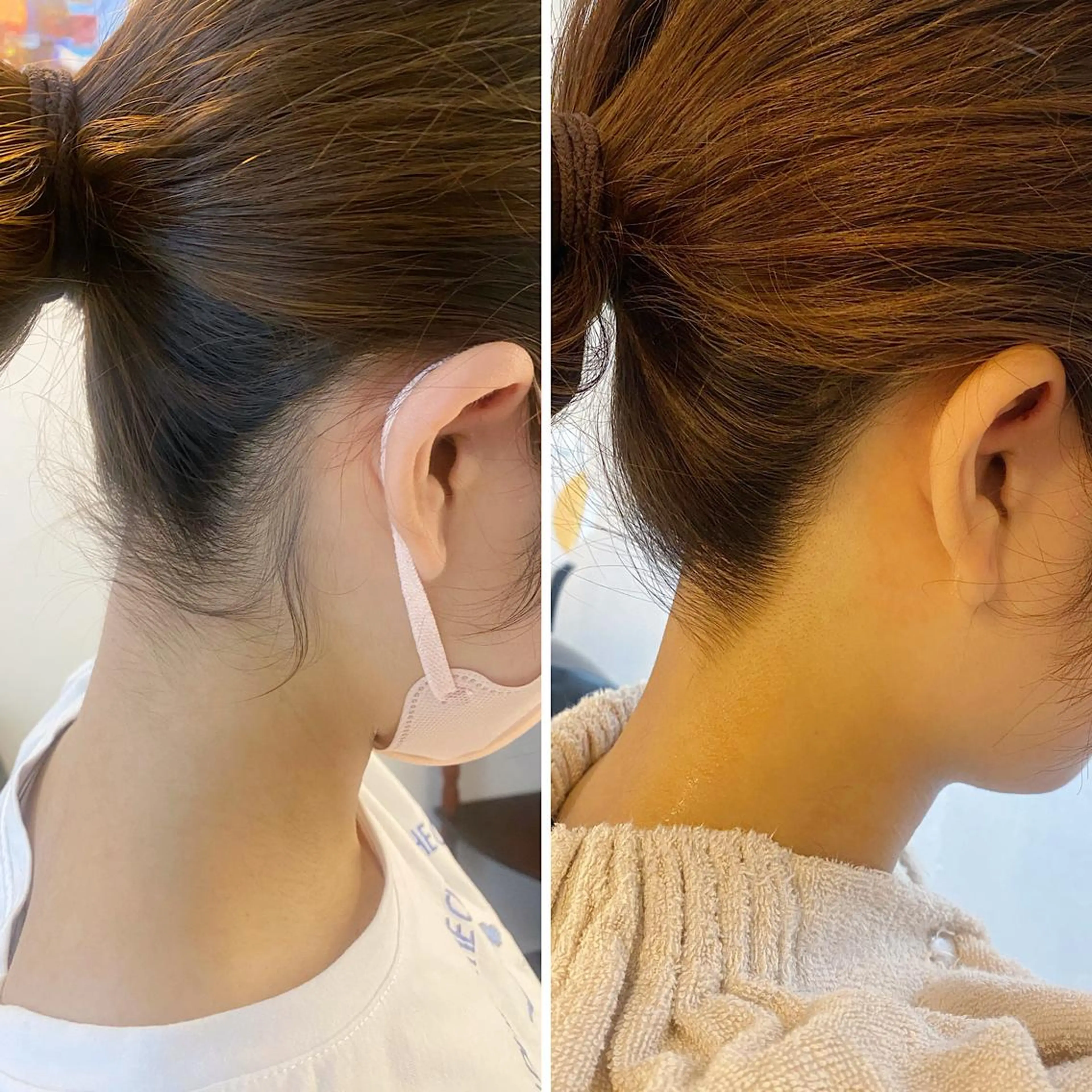 脱毛 うなじ脱毛/美肌脱毛 LABELのエステ・リラクイメージ