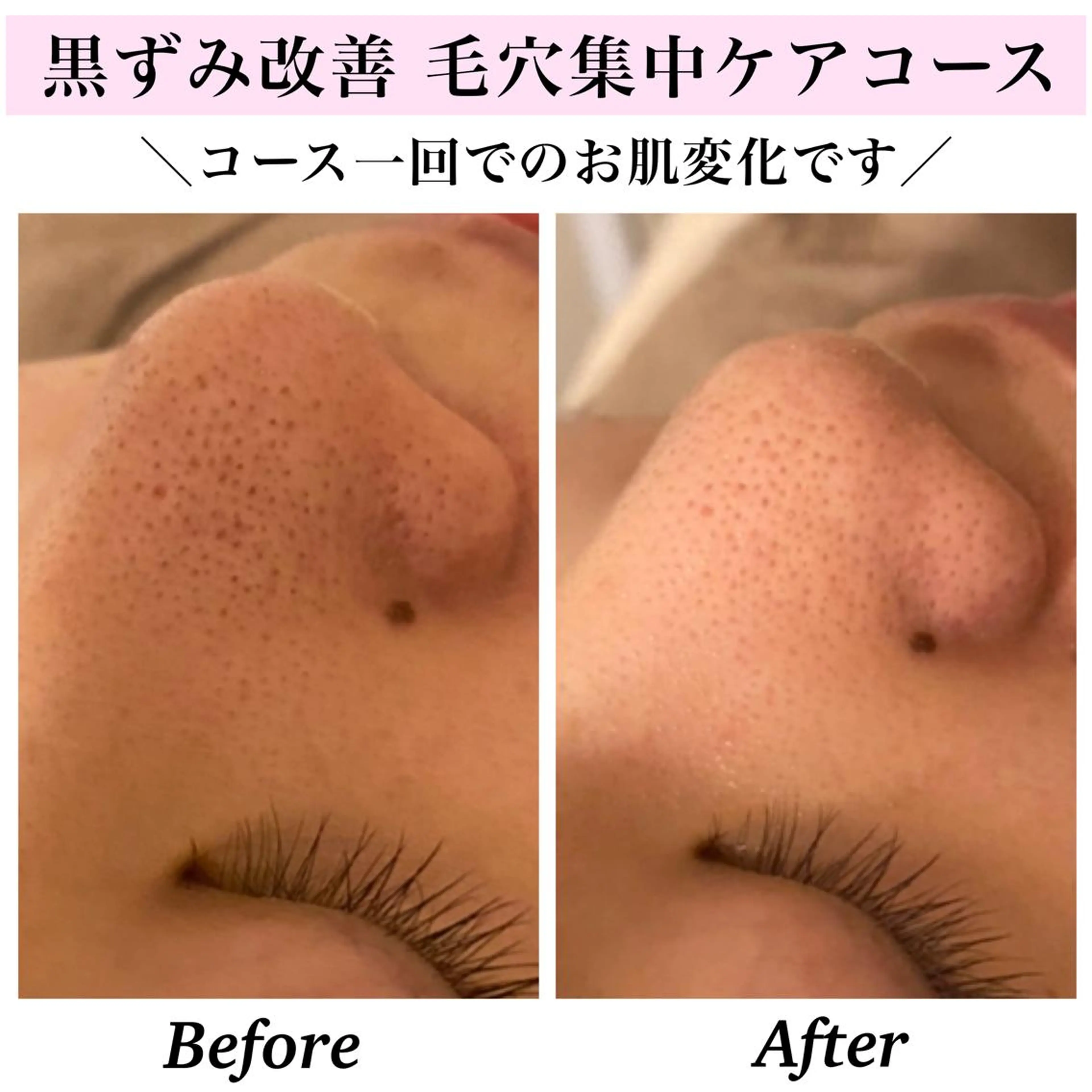 エステ リラク Bellesthe (ベルエステ)のエステ・リラクイメージ