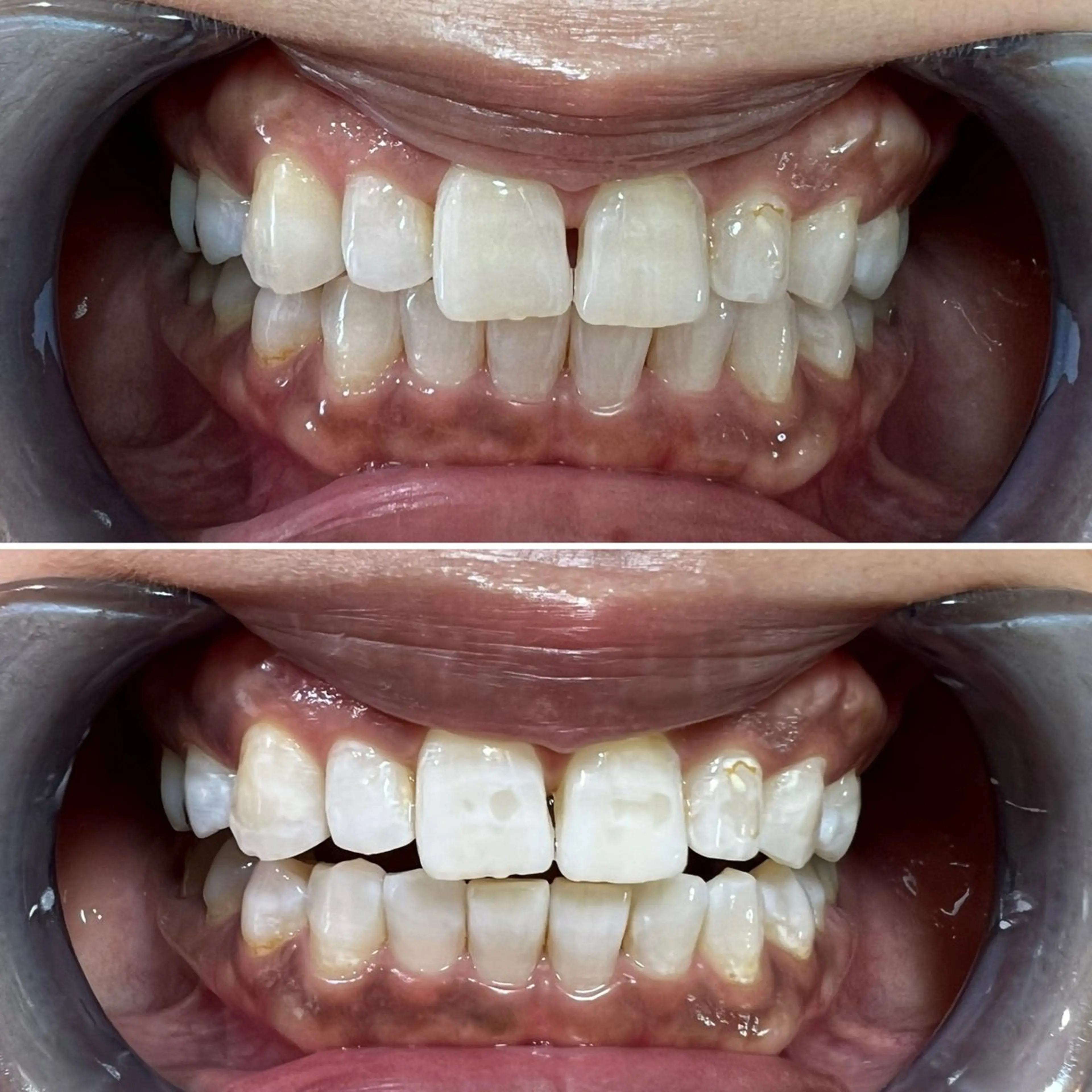 セルフホワイトニング Shineeのエステ・リラクイメージ