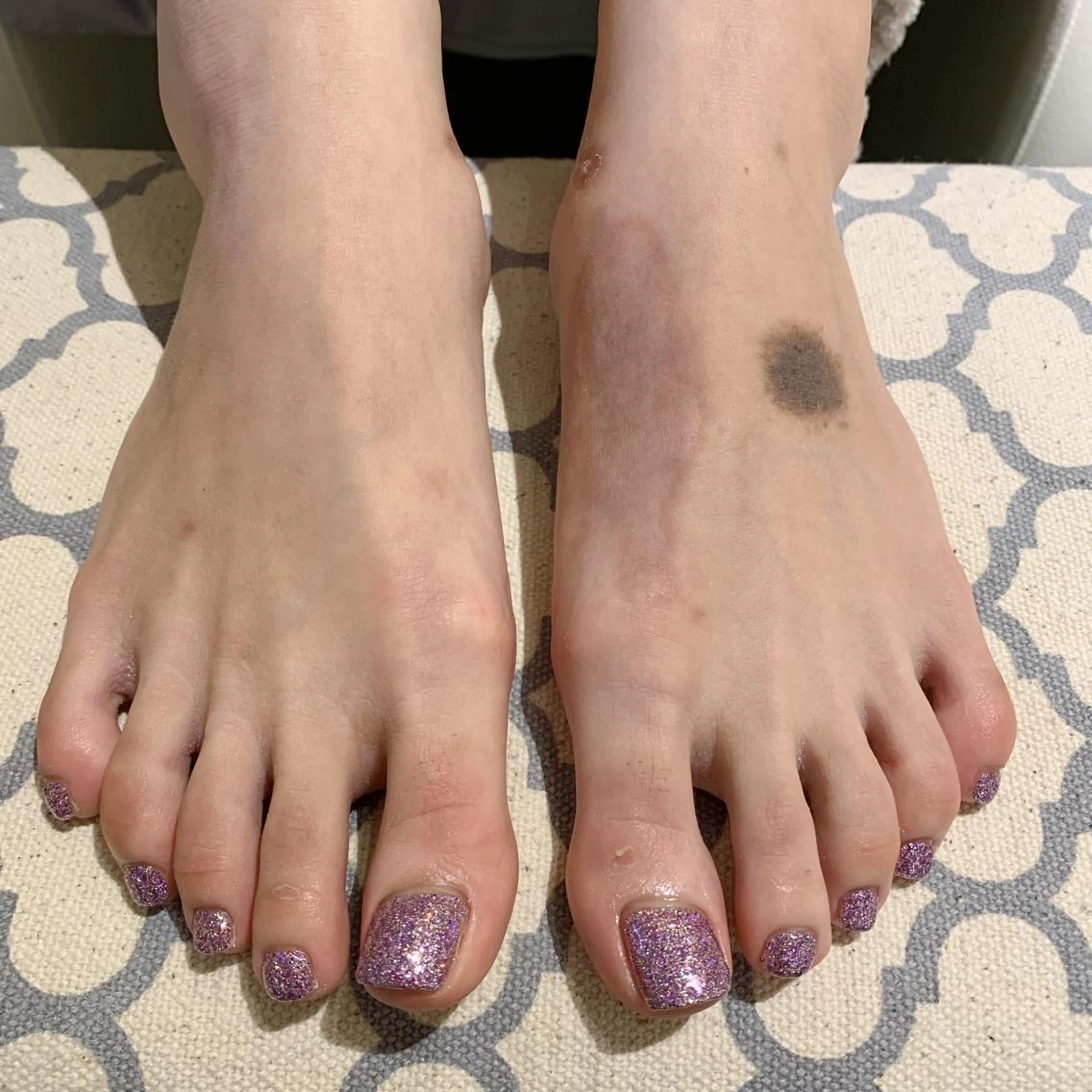ネイル フットネイル ジェルネイル ラメ(グリッター) ワンカラーネイル パラジェル フットネイル 鈴木 里奈のネイルデザイン