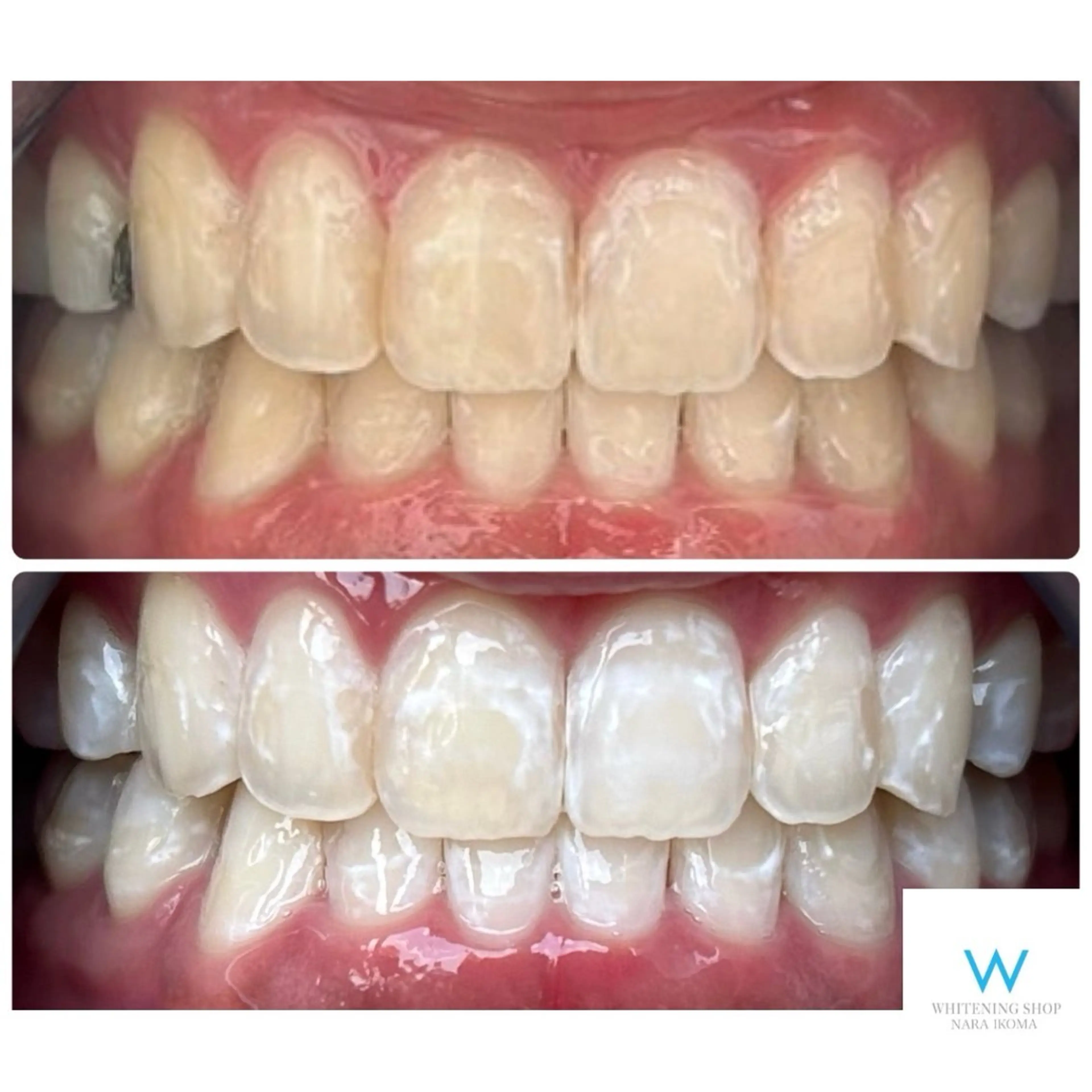 ホワイトニングショップ奈良生駒店所属・乾 理望のエステ・リラクイメージ