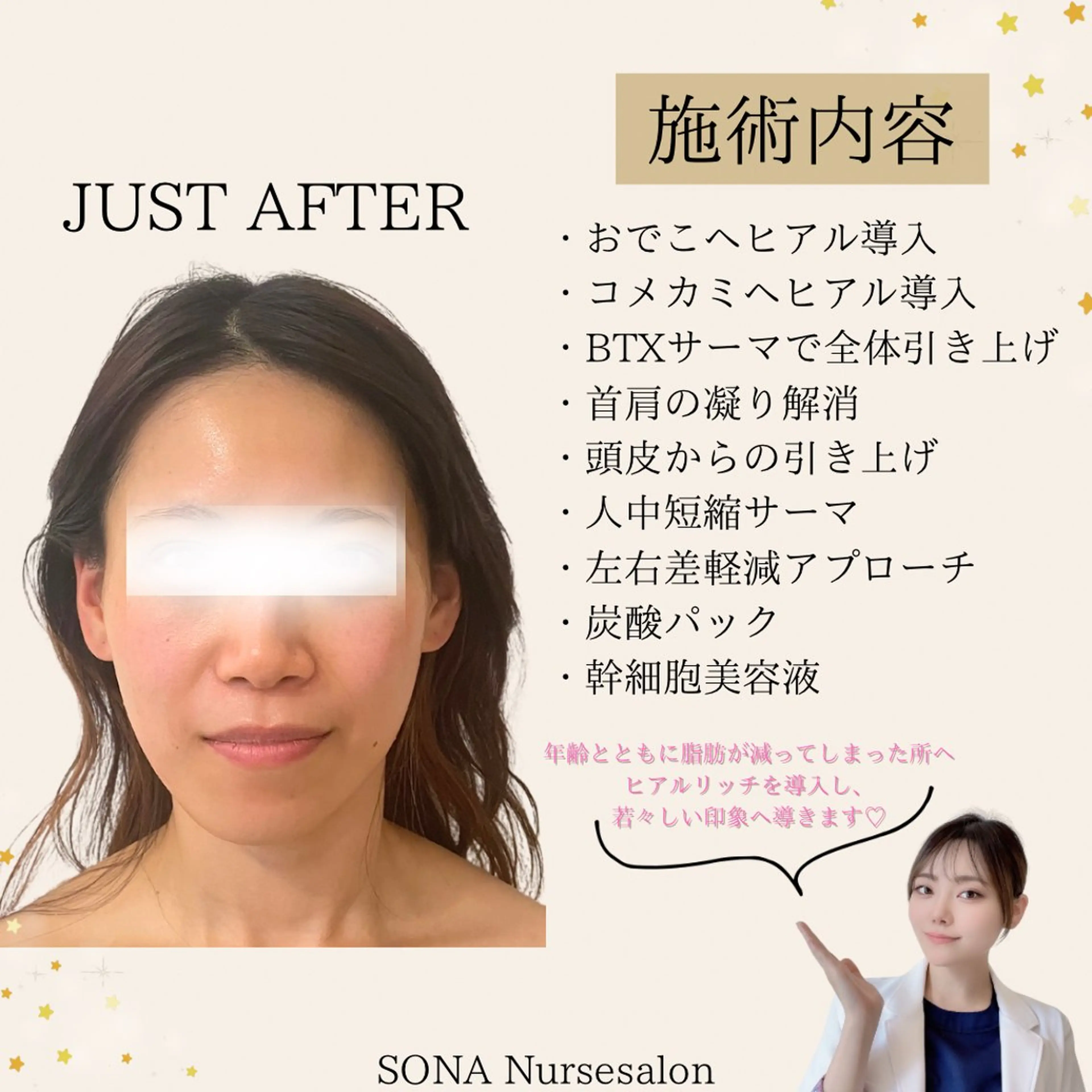エステ 小顔/たるみ/黒ずみ除去専門サロン/SONA 大和西大寺店所属・【小顔専門看護師 サロンSONA】のエステ・リラクイメージ