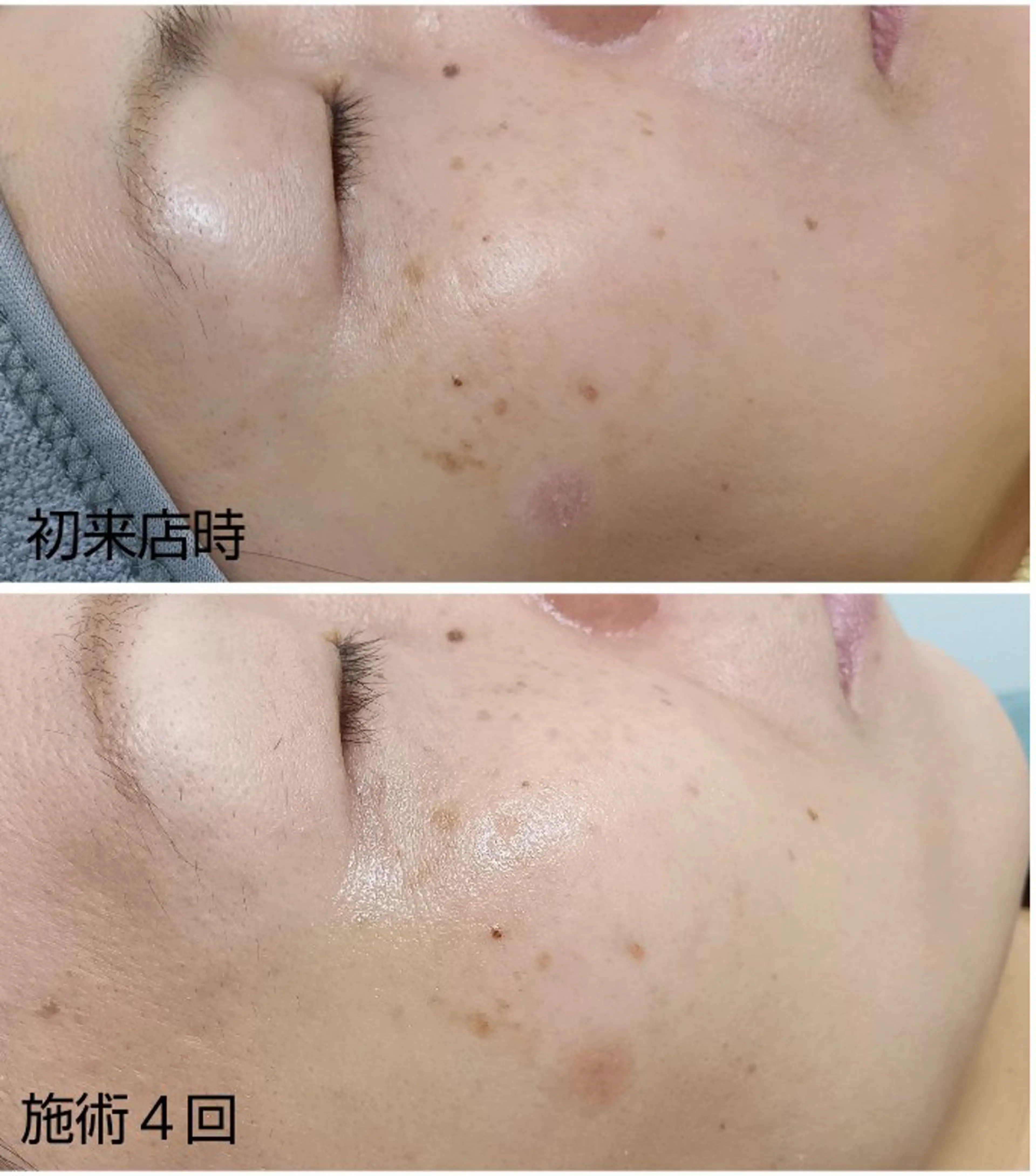 シミケア専門店 HAQUAのその他イメージ