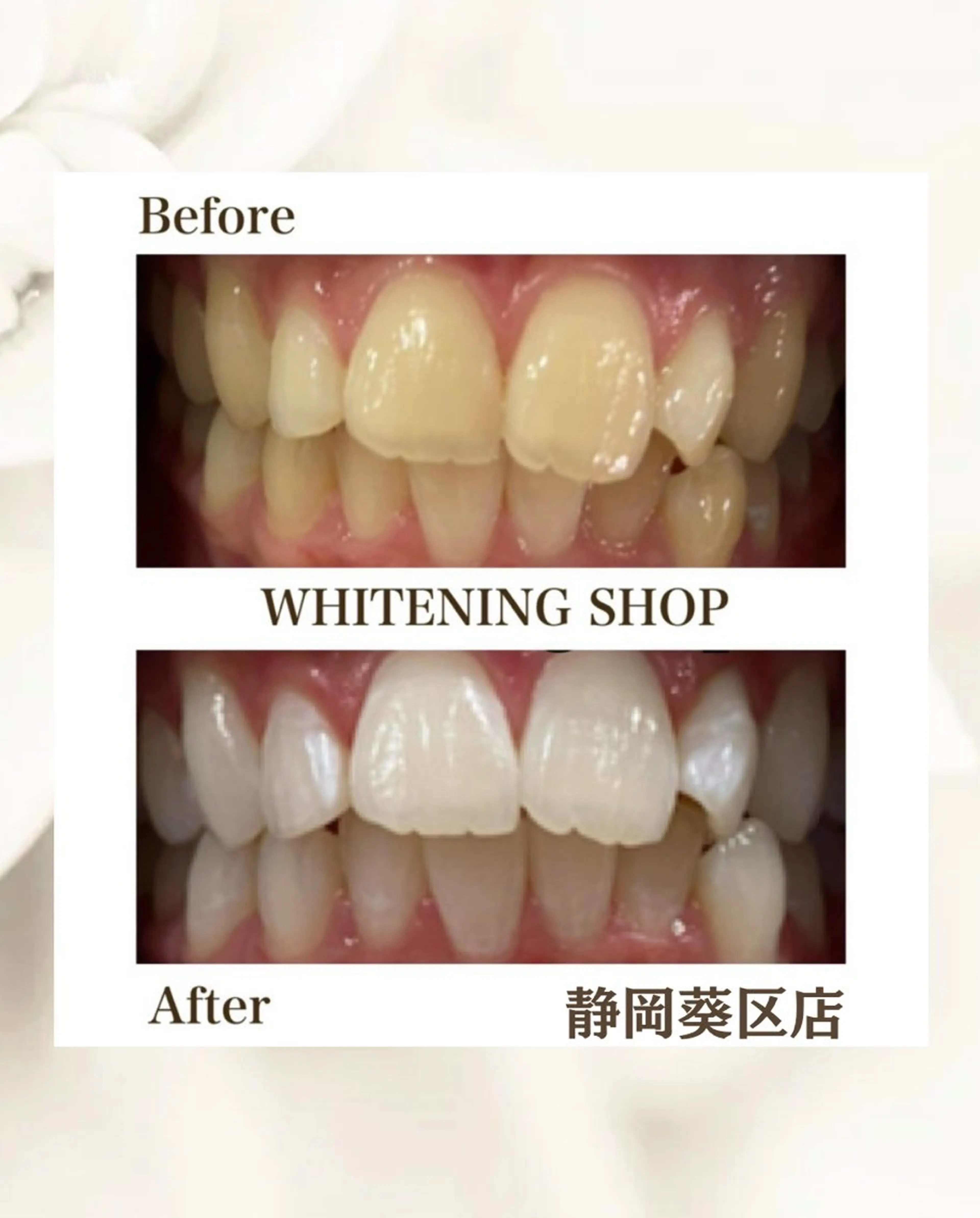 その他 ホワイトニングショップ静岡葵区店所属・ホワイトニング ショップ葵区静岡駅店のその他イメージ