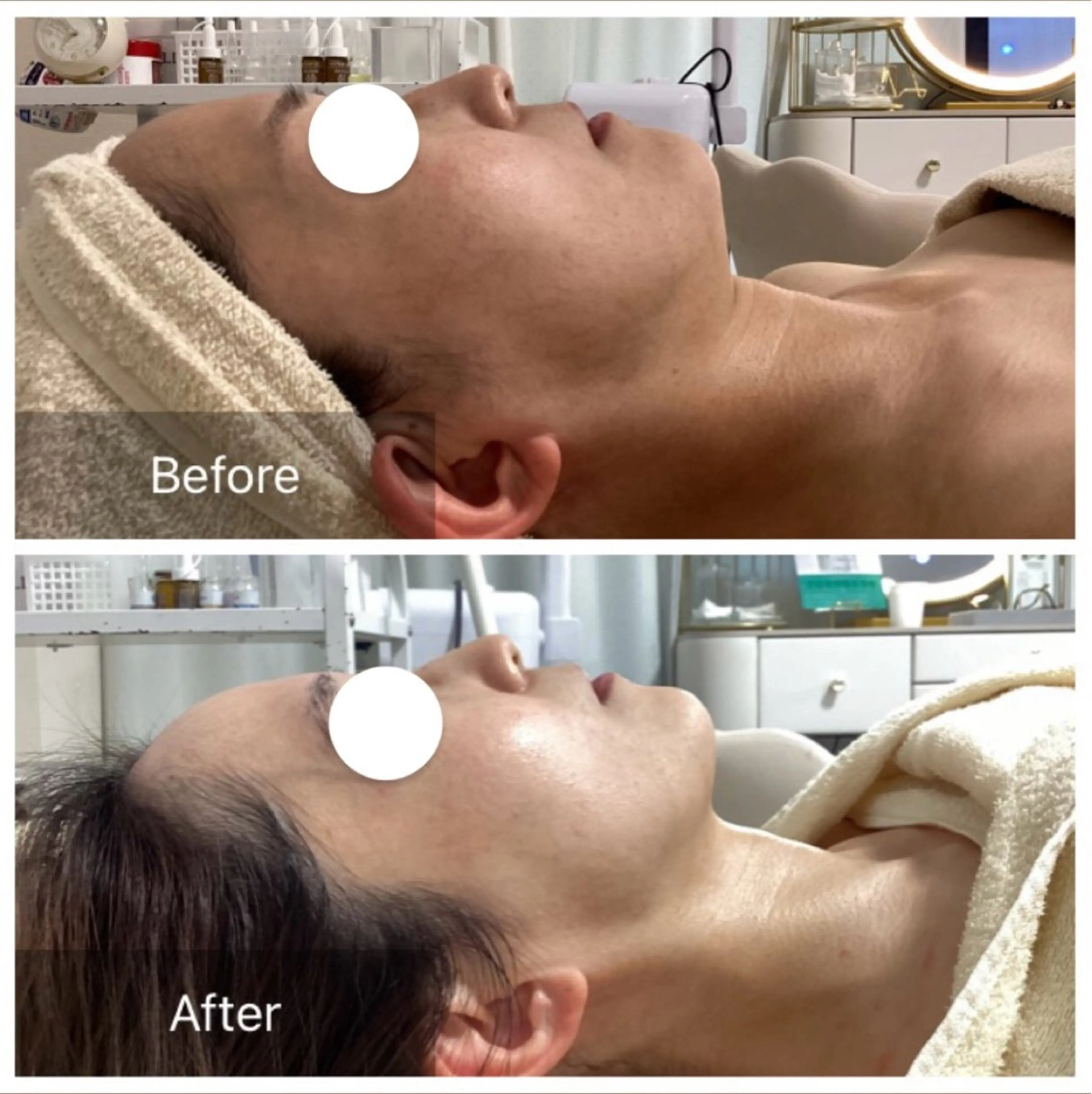 【むくみ/小顔/お疲れ顔/疲労回復】本格韓国式コルギ(パック付) 50 分の写真