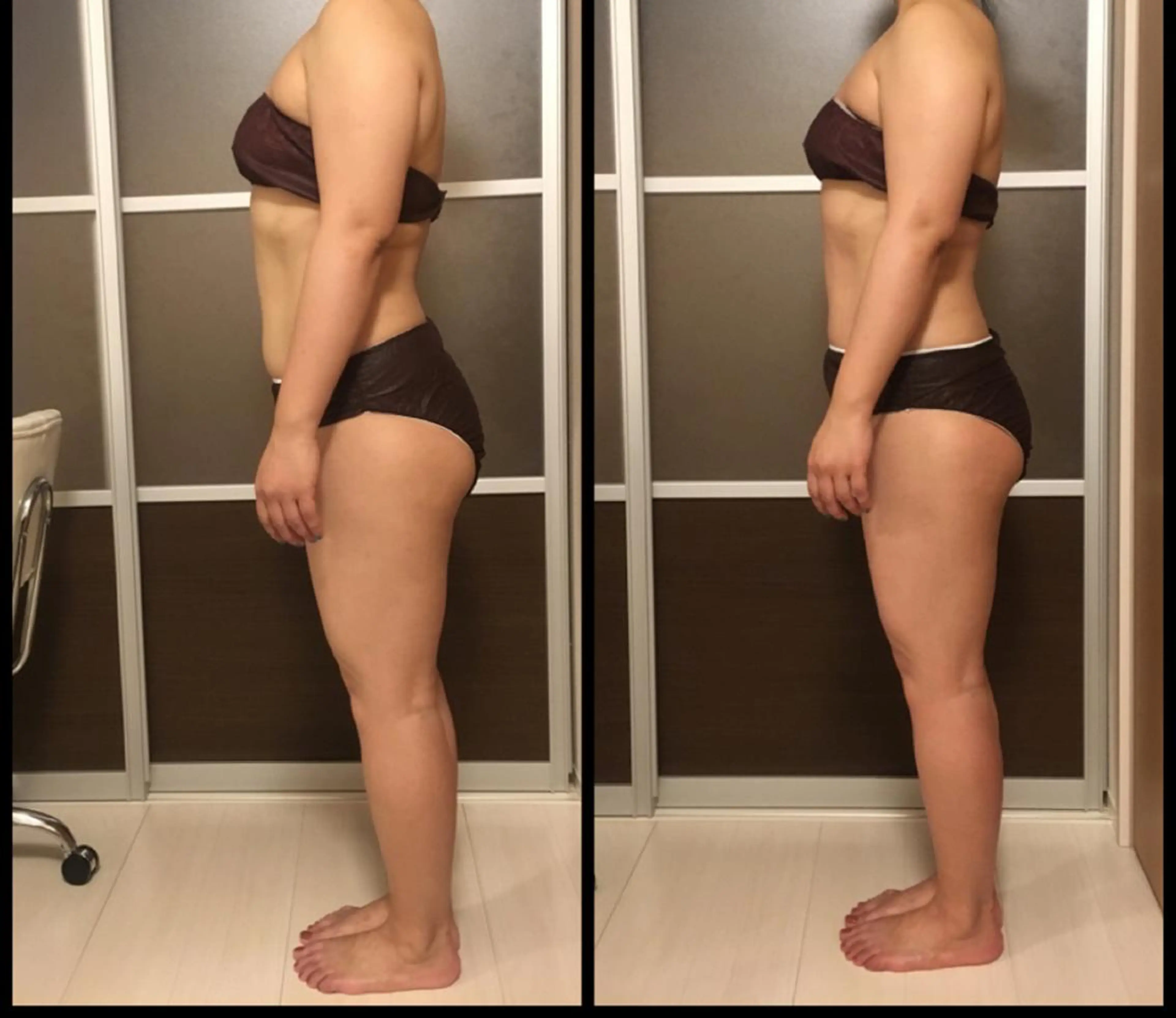 ミディアム カラー パーマ ヘアアレンジ キッズ アニメ,Vオタク× 即効痩せエステサロンのエステ・リラクイメージ