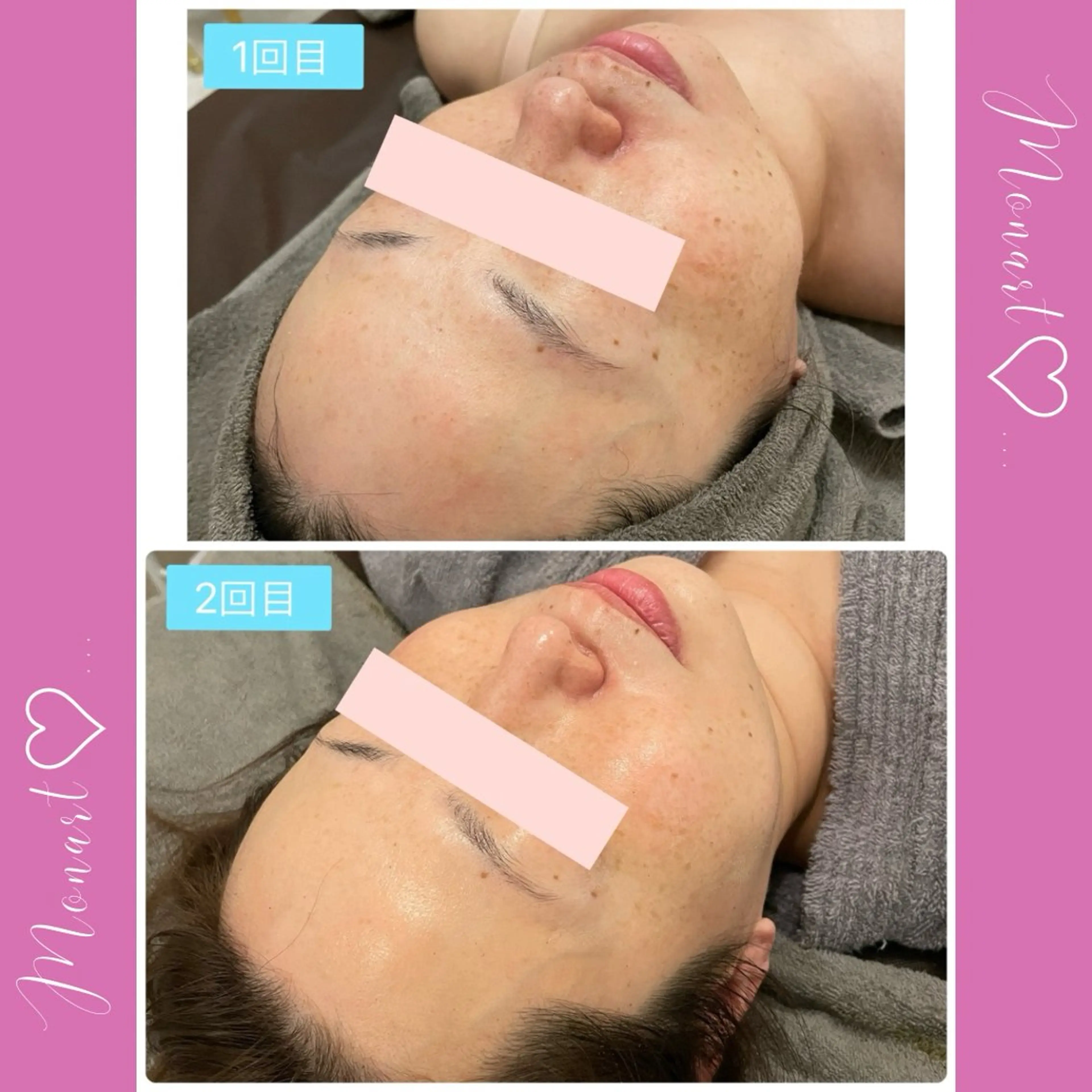 Monart -deux-のエステ・リラクイメージ