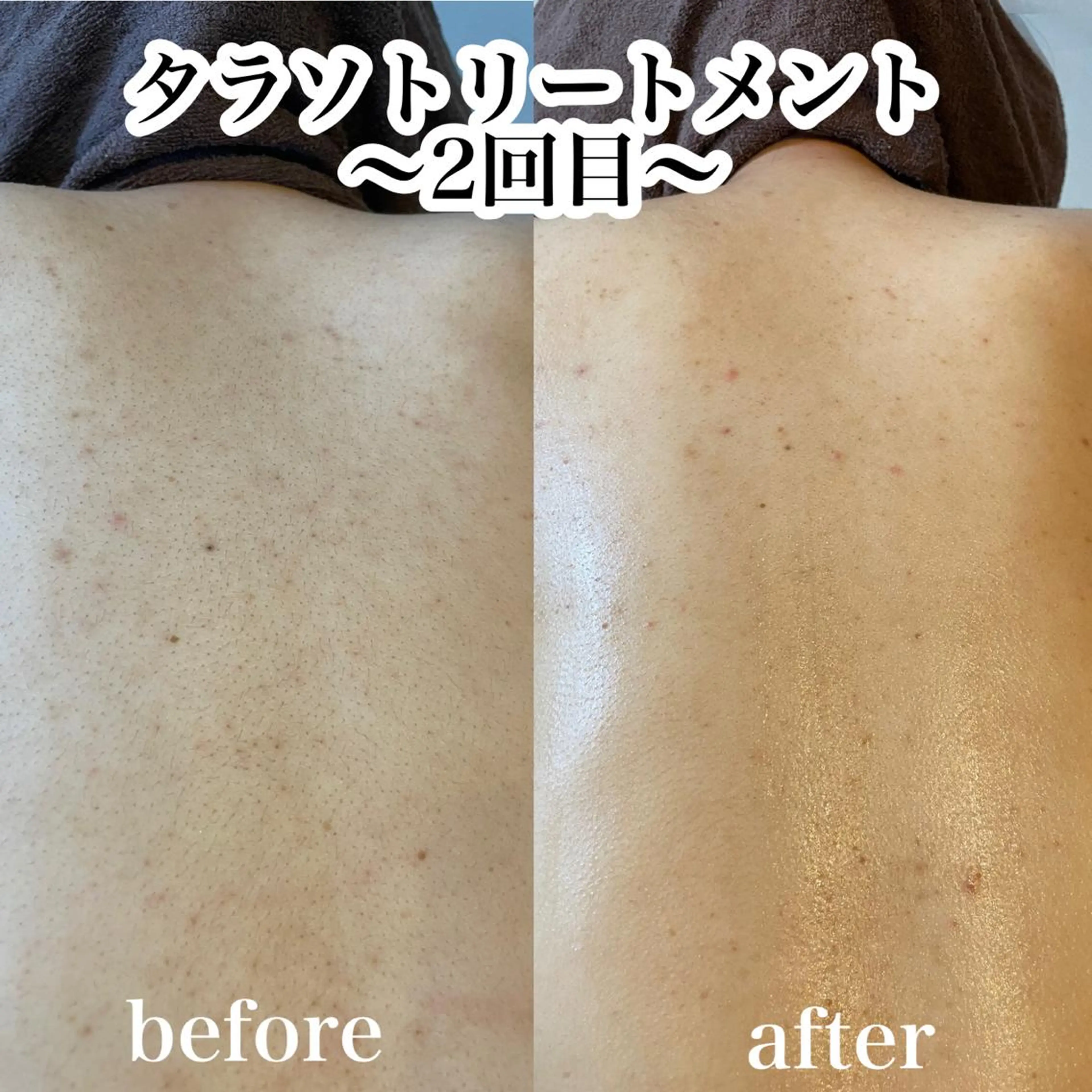 エステ 浜野 恵美のエステ・リラクイメージ