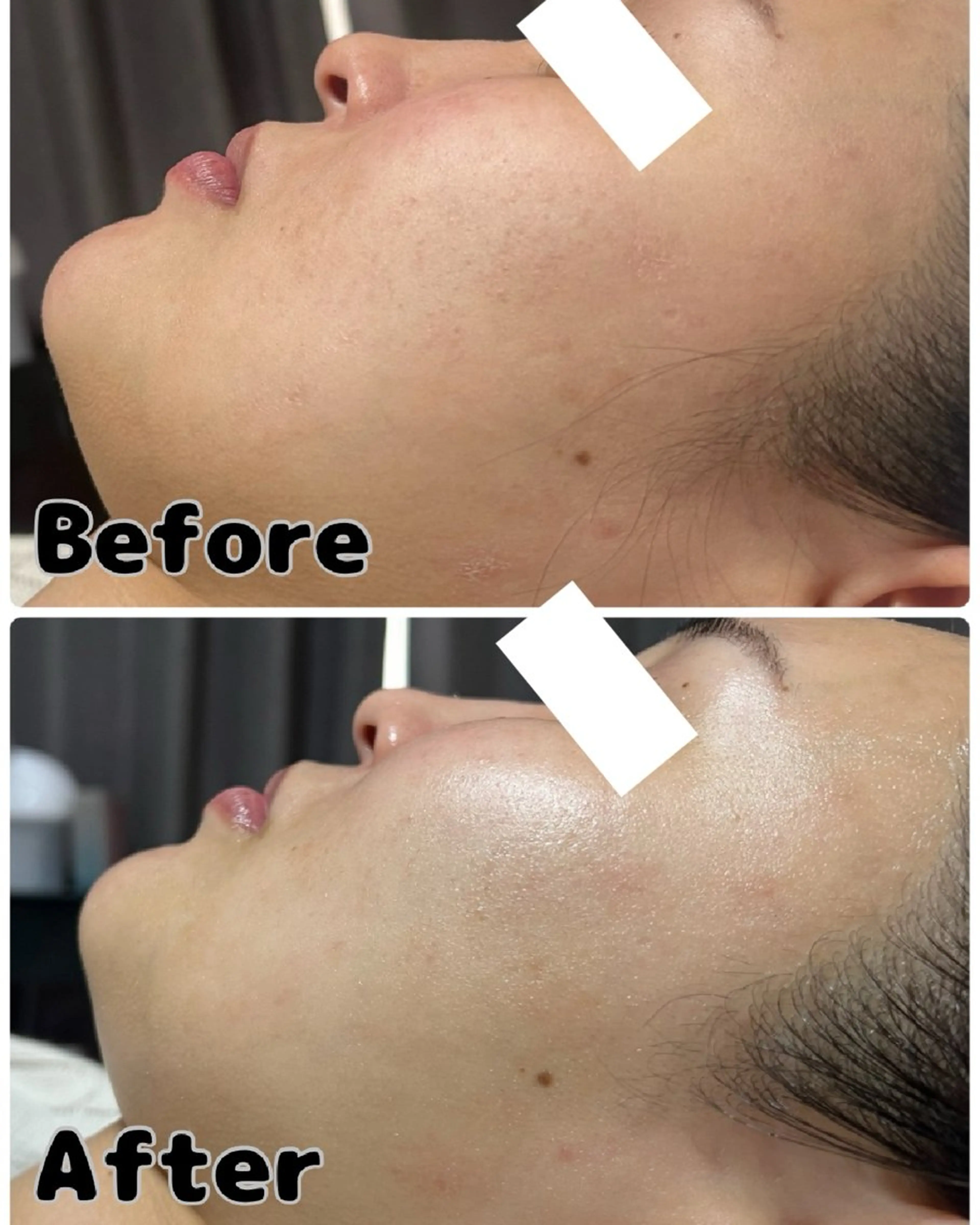 エステ ROR Akariのエステ・リラクイメージ