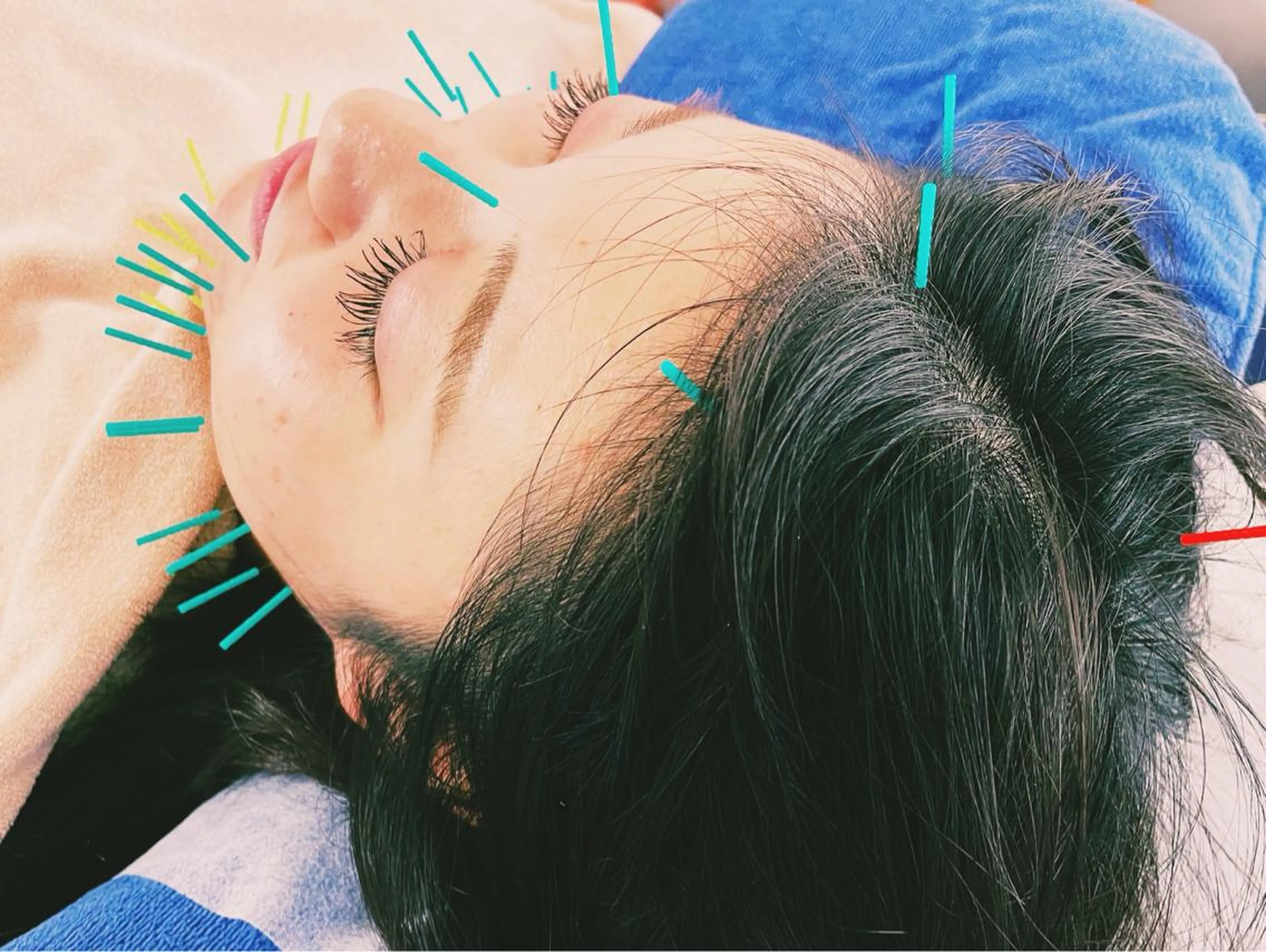 エステ リラク 小顔美容鍼専門サロン 渋谷YZのその他イメージ