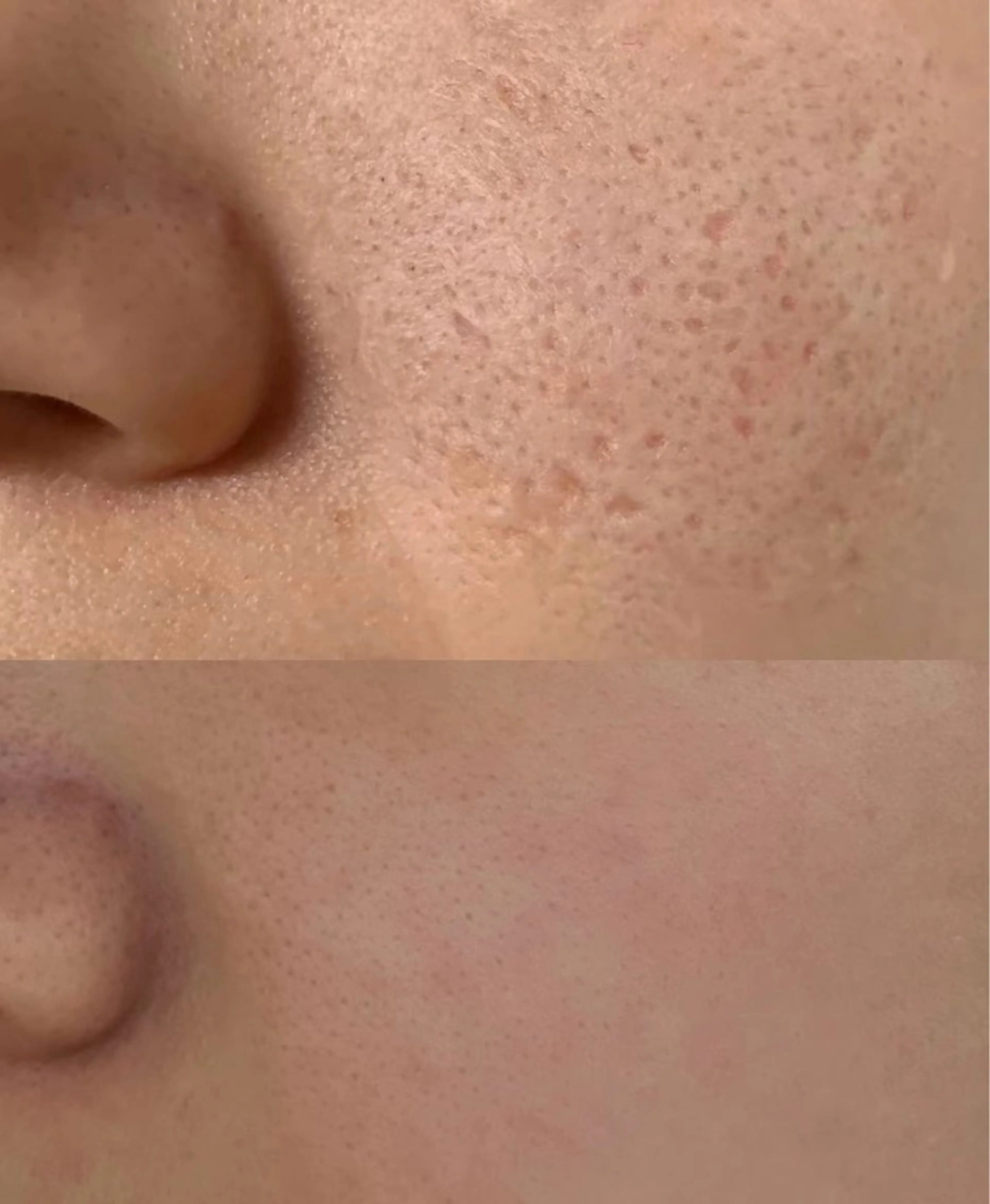 ネイル エステ aliaハイフ&水光ジェットサロン所属・aliaハーブ水光店 エステティシャン募集のエステ・リラクイメージ