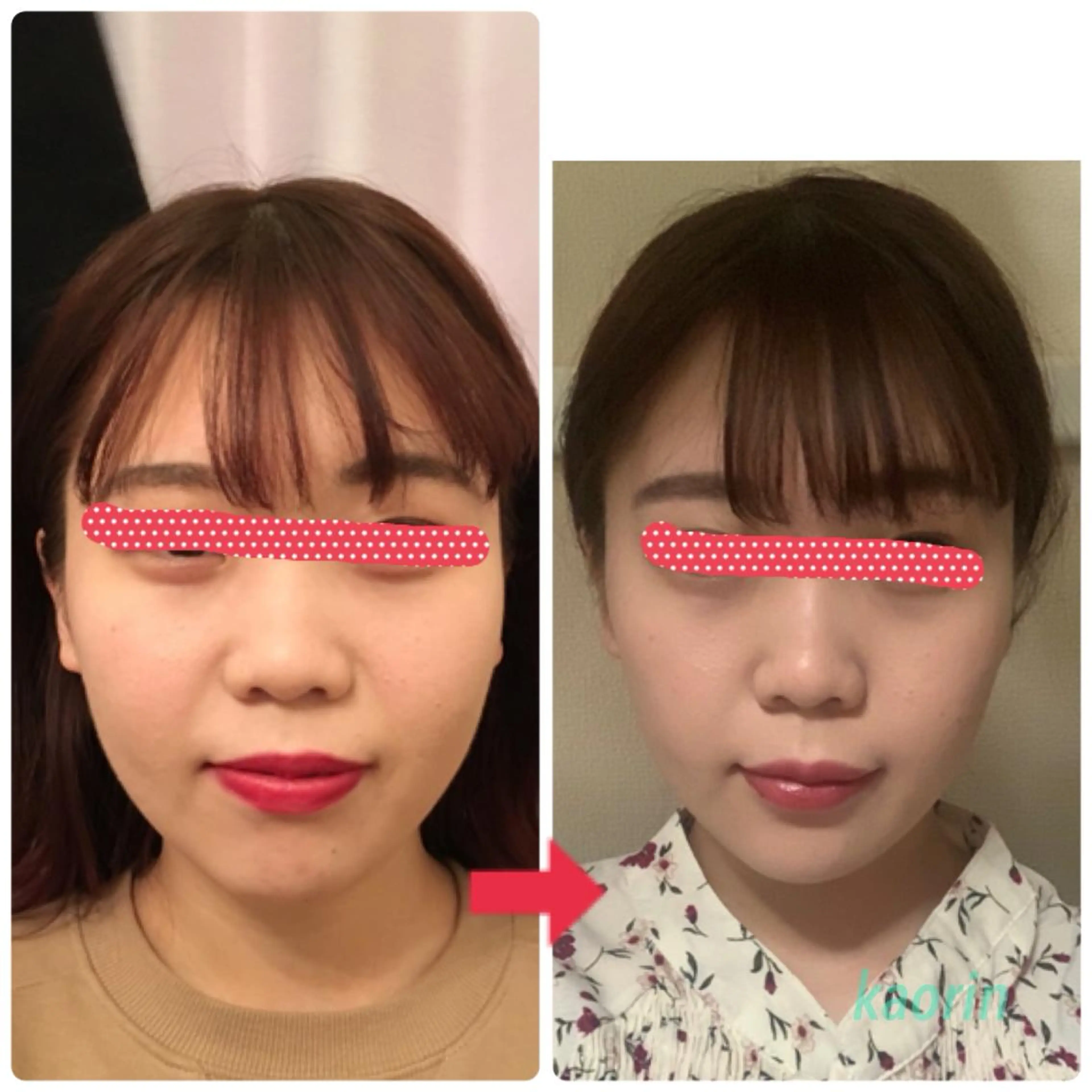 受けたらあなたも福岡美人❣️の写真