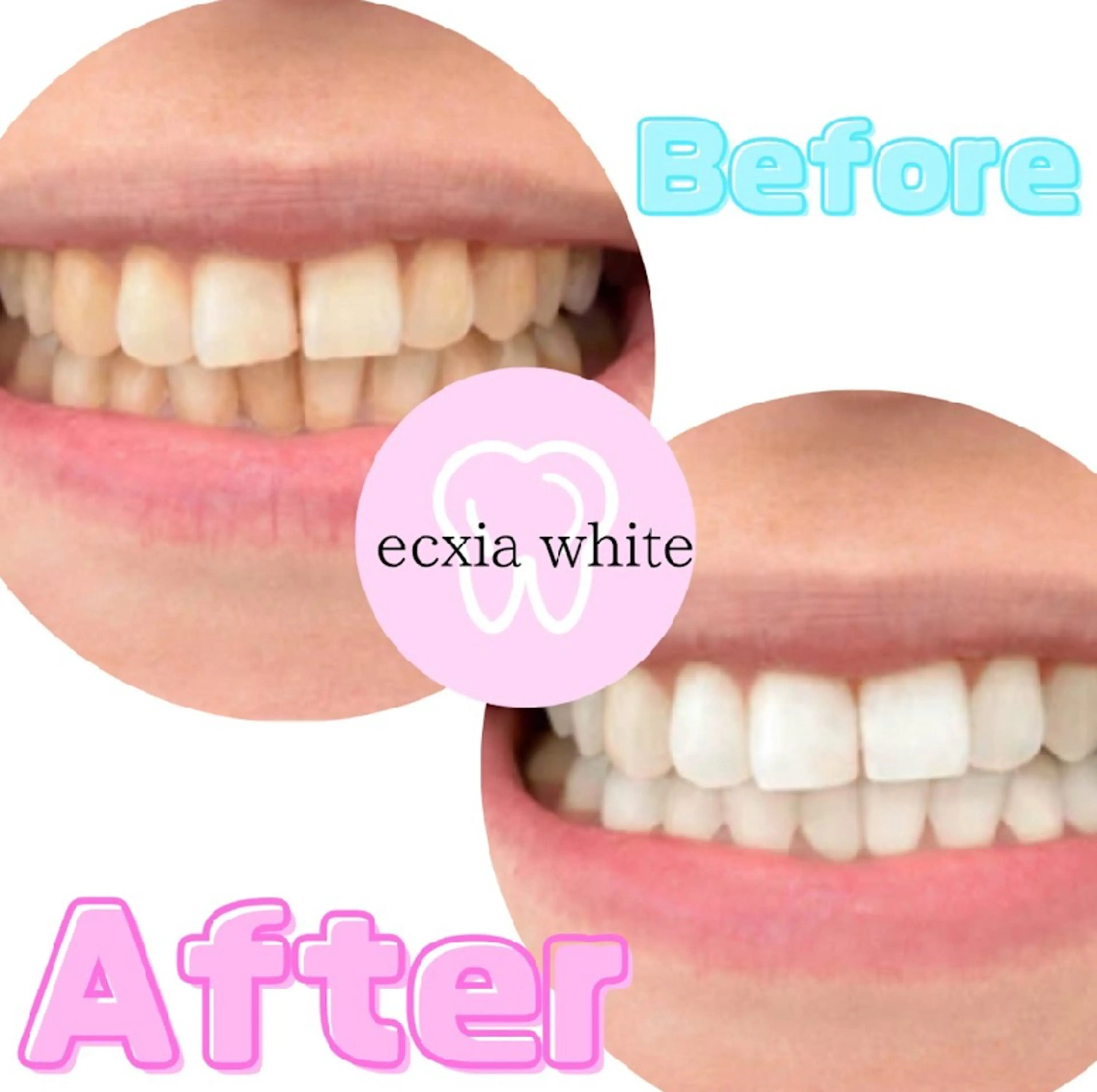 メンズ その他 エクシアホワイトニング草津店所属・nanami -ホワイトニングのその他イメージ