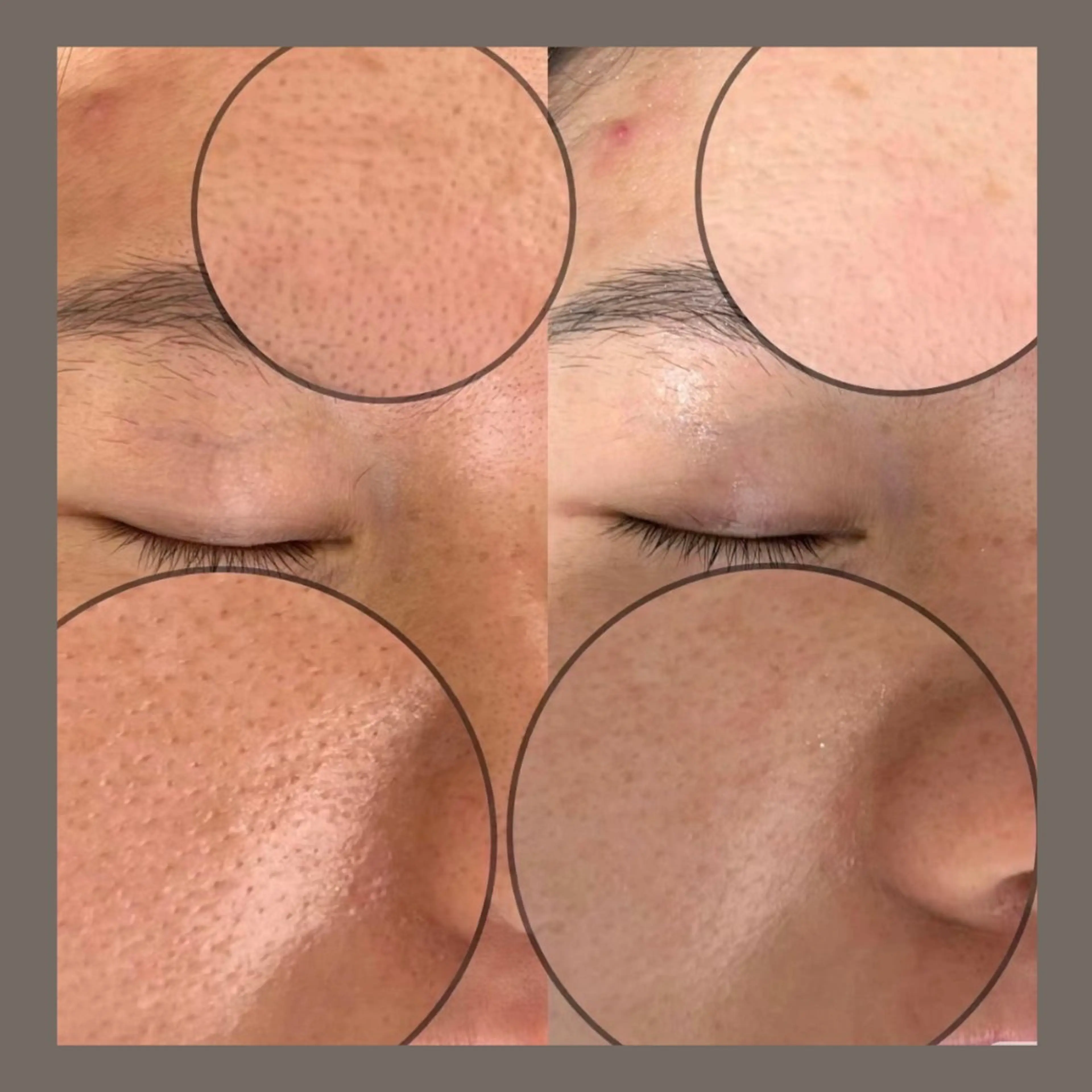 エステ リラク 愛維美水光美肌専門店所属・愛維美水光美肌専門店 メンズレディースokのエステ・リラクイメージ