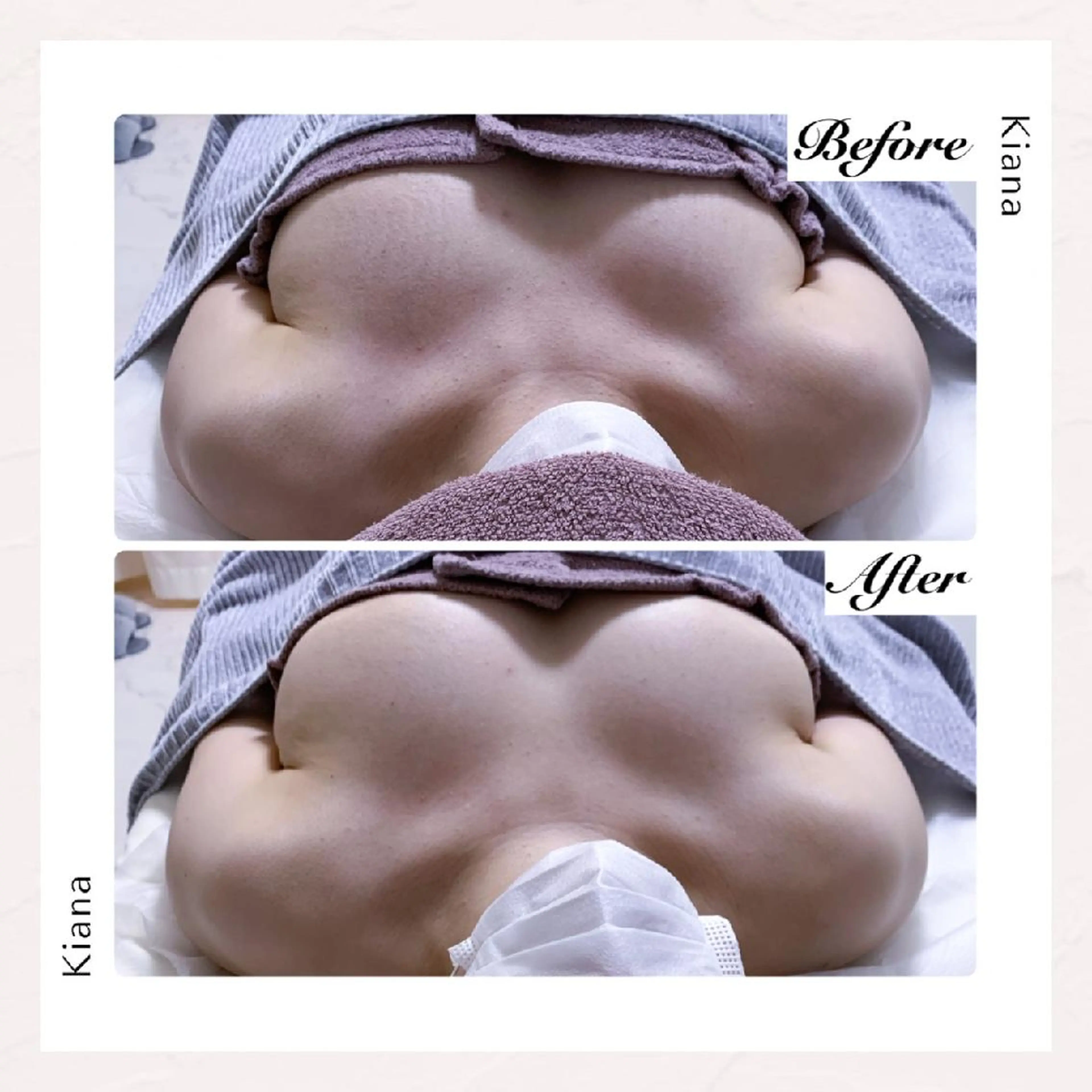 【バスト専門店 】 Kiana のエステ・リラクイメージ