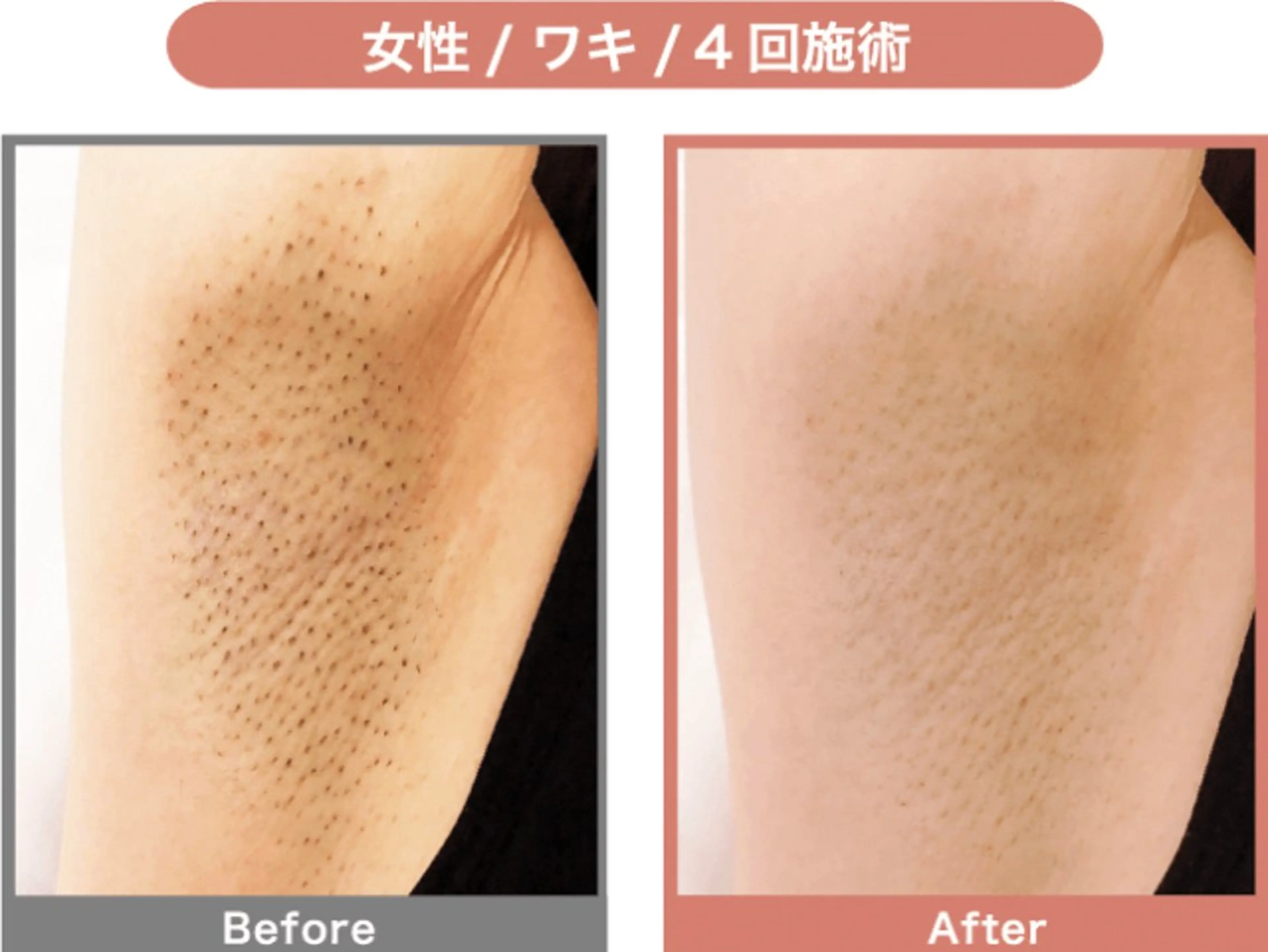 脱毛 脱毛&フェイシャル 専門店muro.のエステ・リラクイメージ