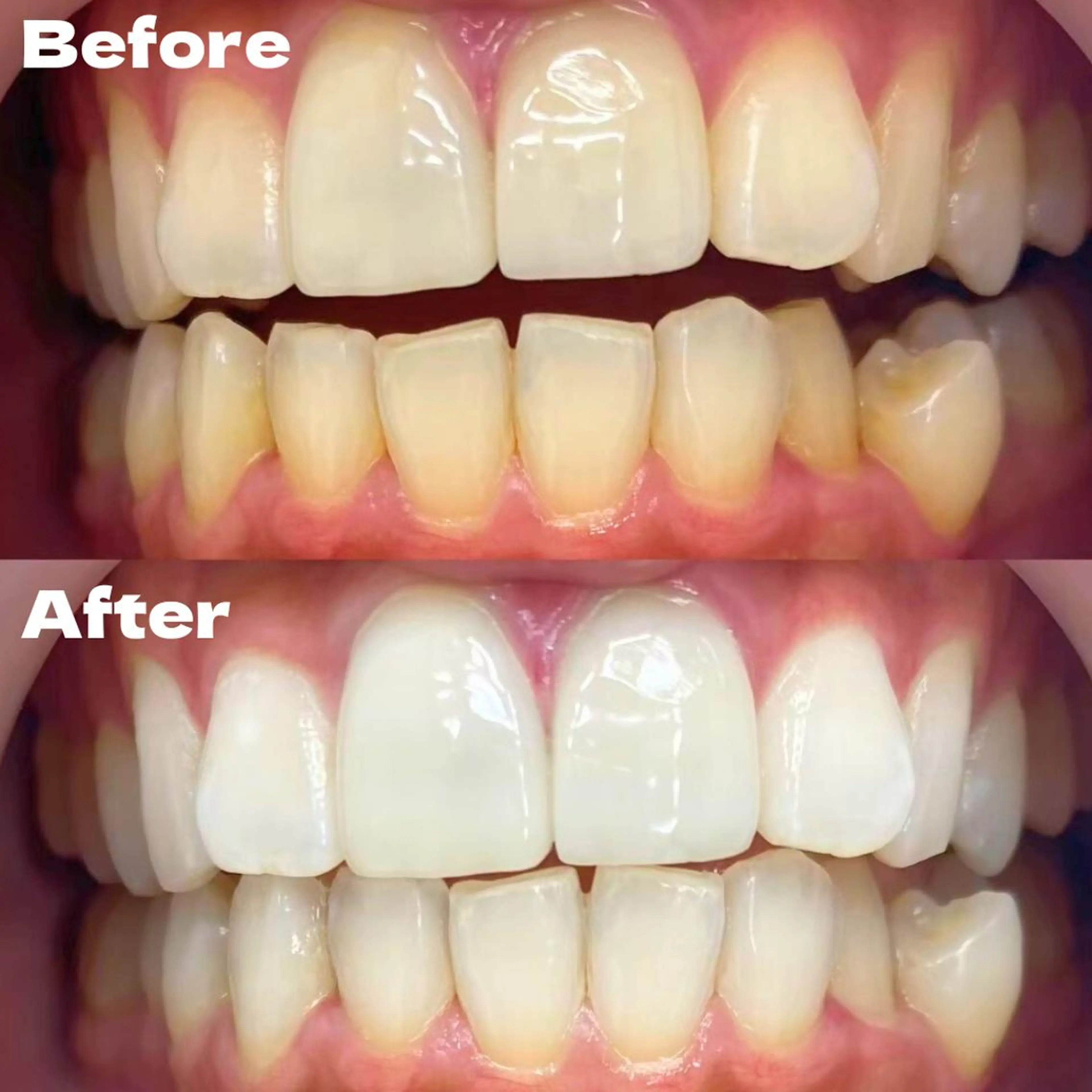 LBSホワイトニング 銀座店💎公式のその他イメージ