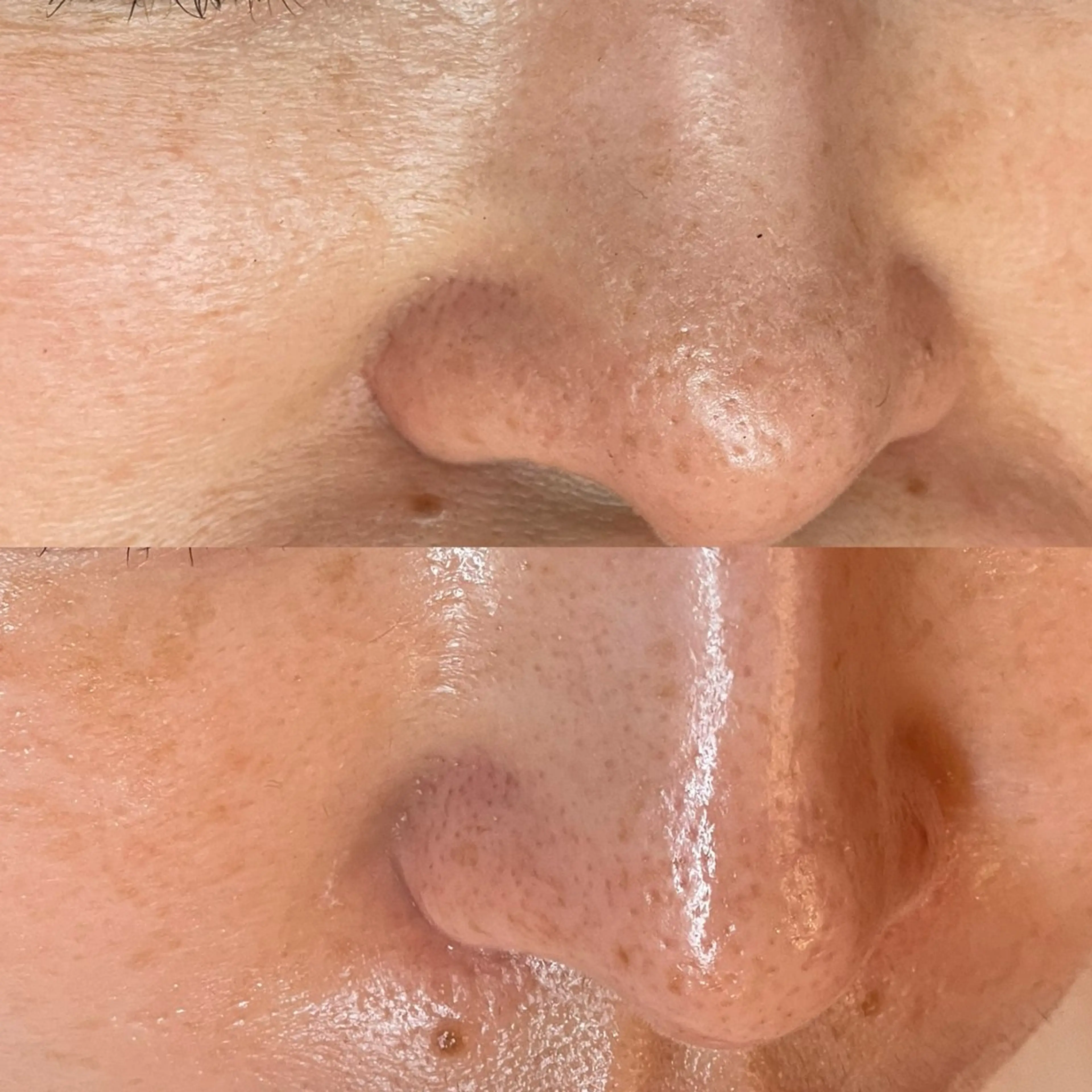 エステ CHARMER 韓国式美肌サロンの眉毛・アイブロウイメージ