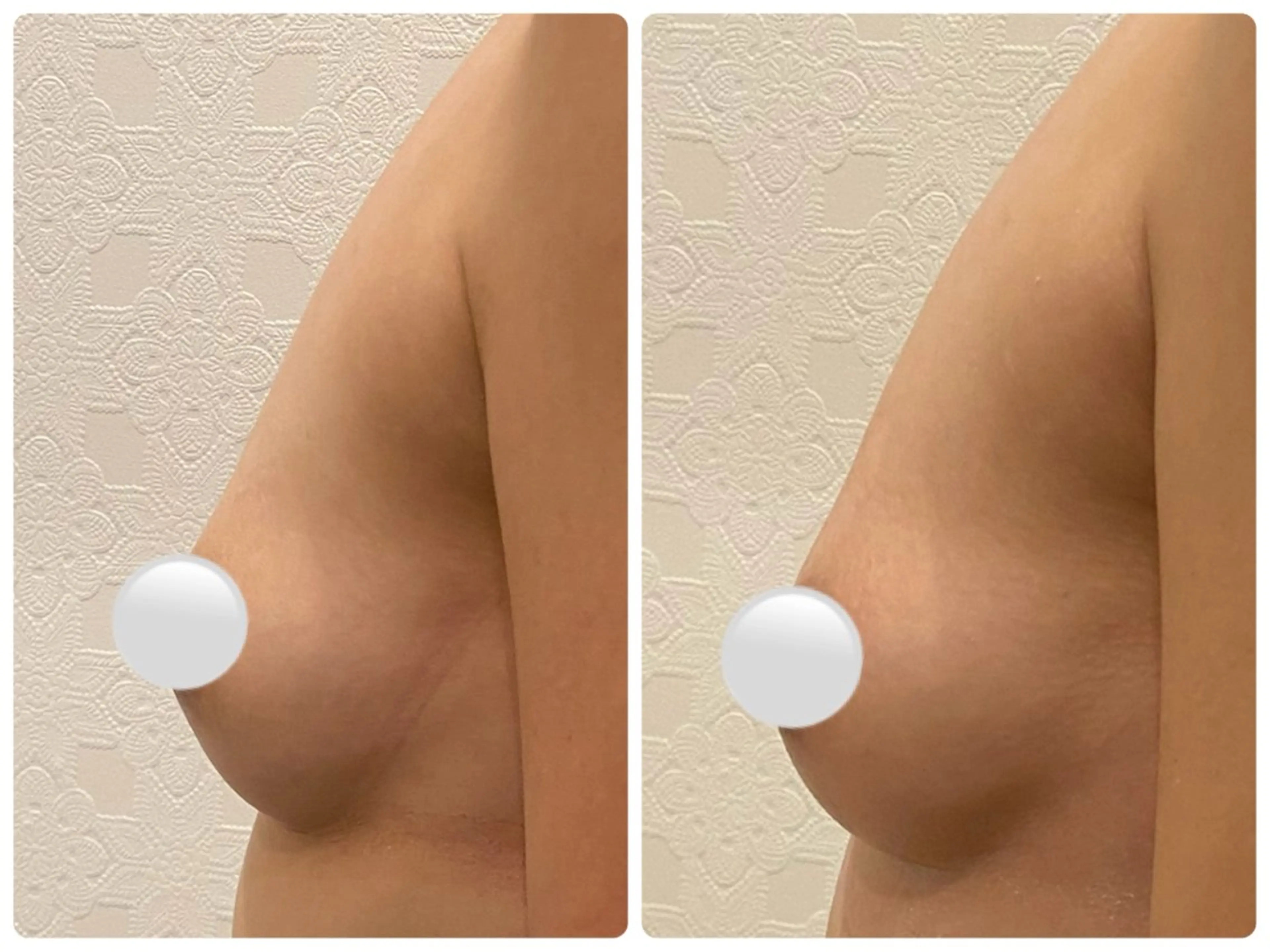 バストアップ専門店HAKU所属・茨田 恵のエステ・リラクイメージ