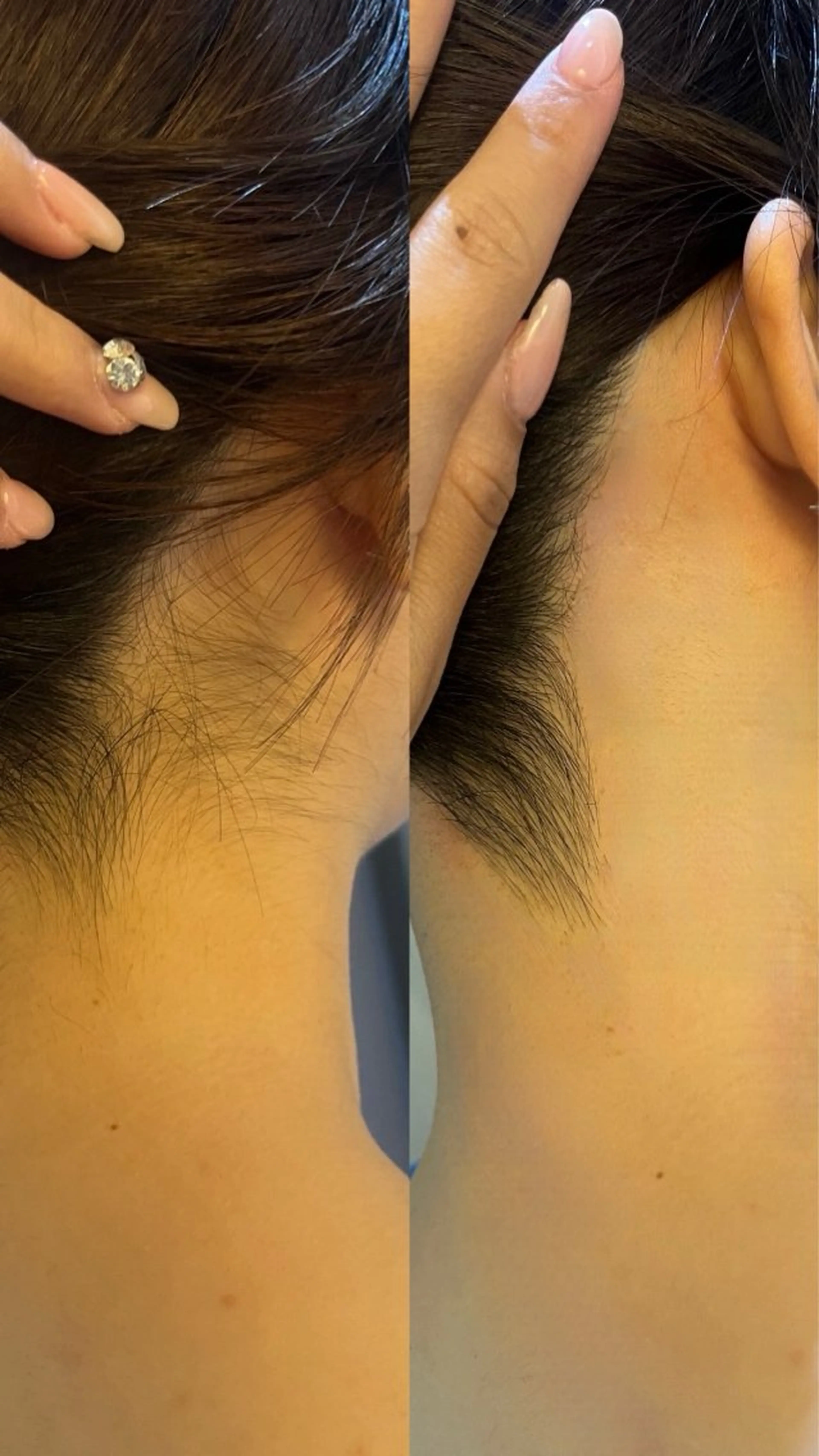 うなじ脱毛/美肌脱毛 LABELのエステ・リラクイメージ