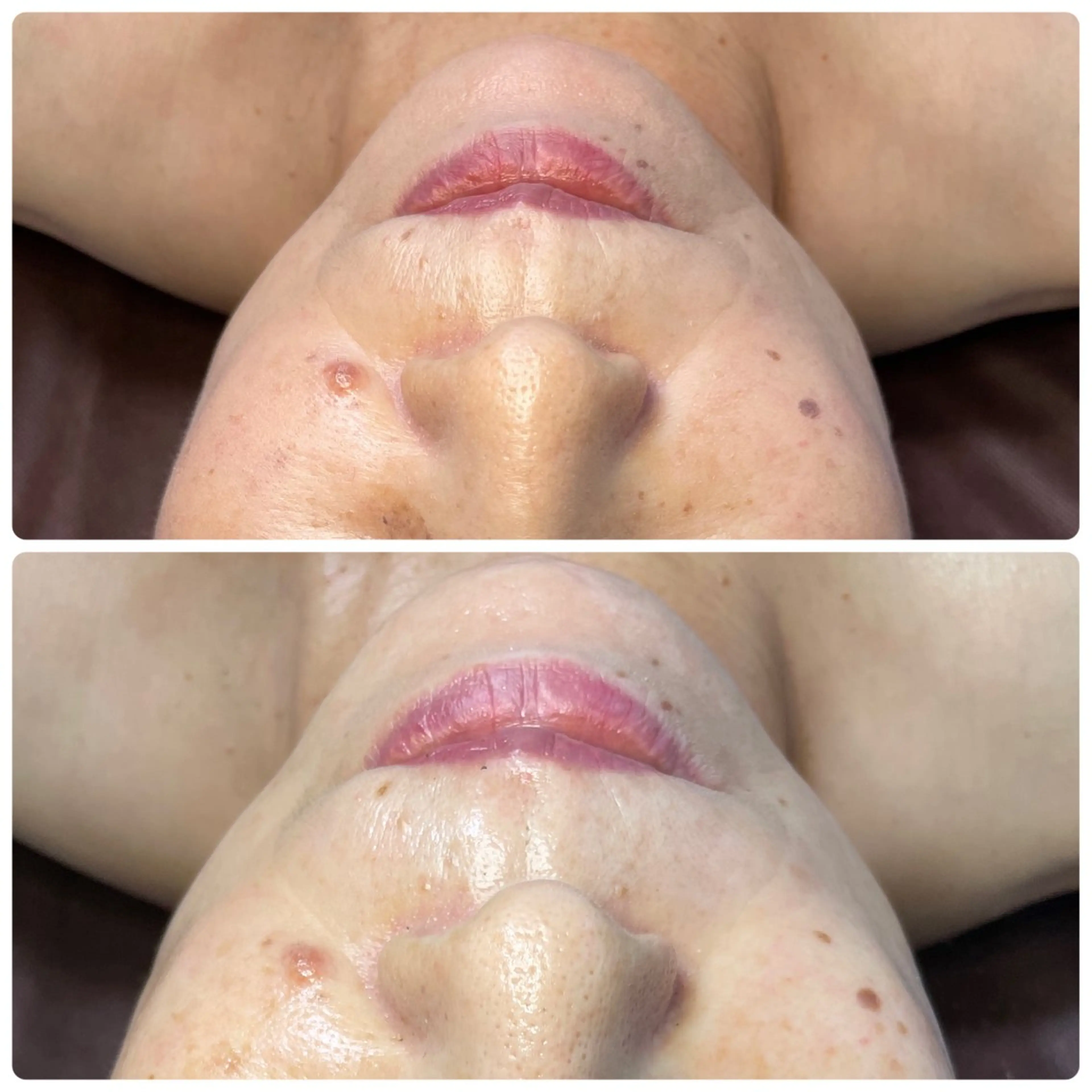 エステ 肌育脱毛サロン LikoLinaのその他イメージ