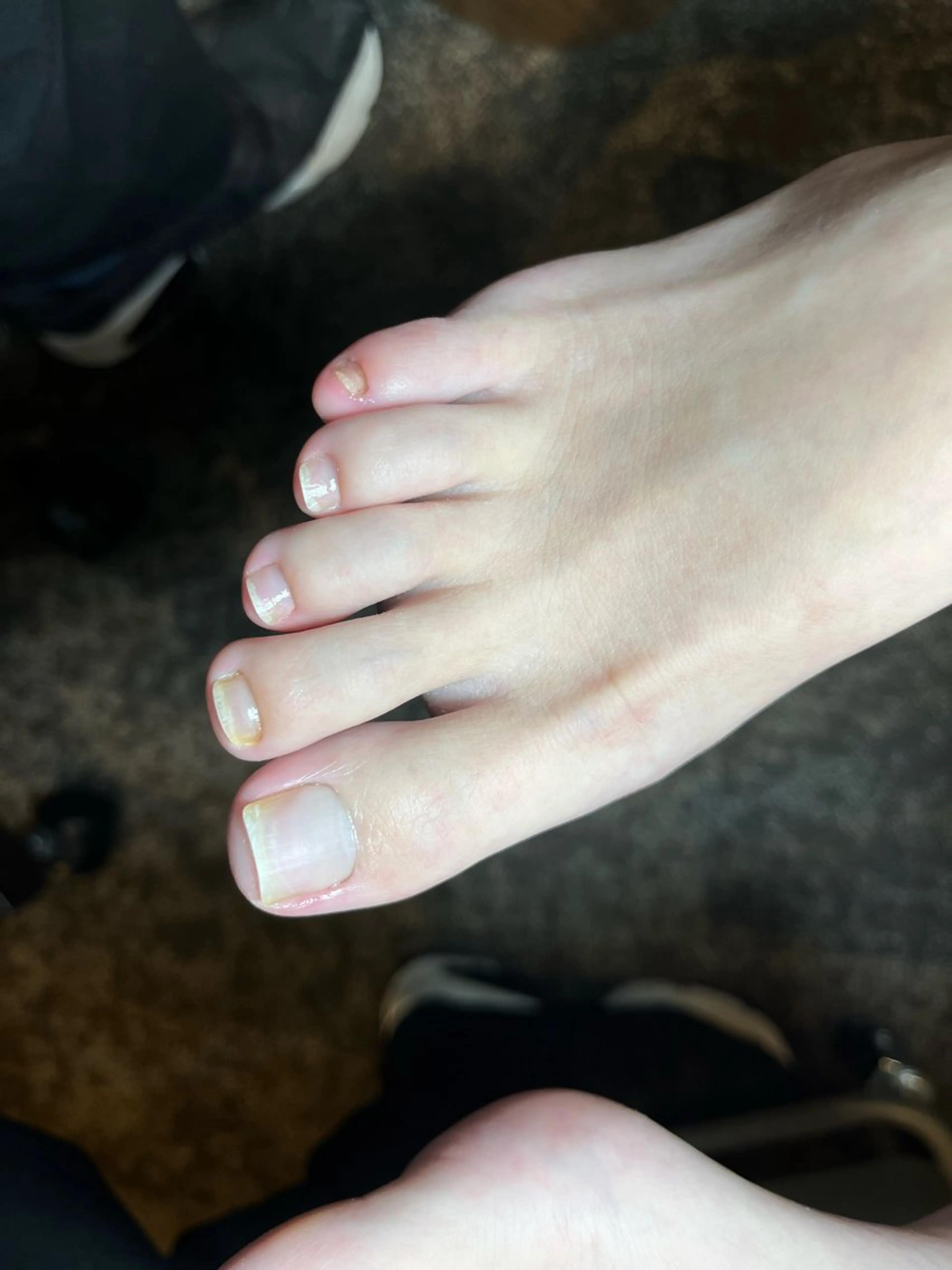 ネイル オフのみ(ネイル) NAILSALON FROSCH所属・FROSCH/ 凜のネイルデザイン