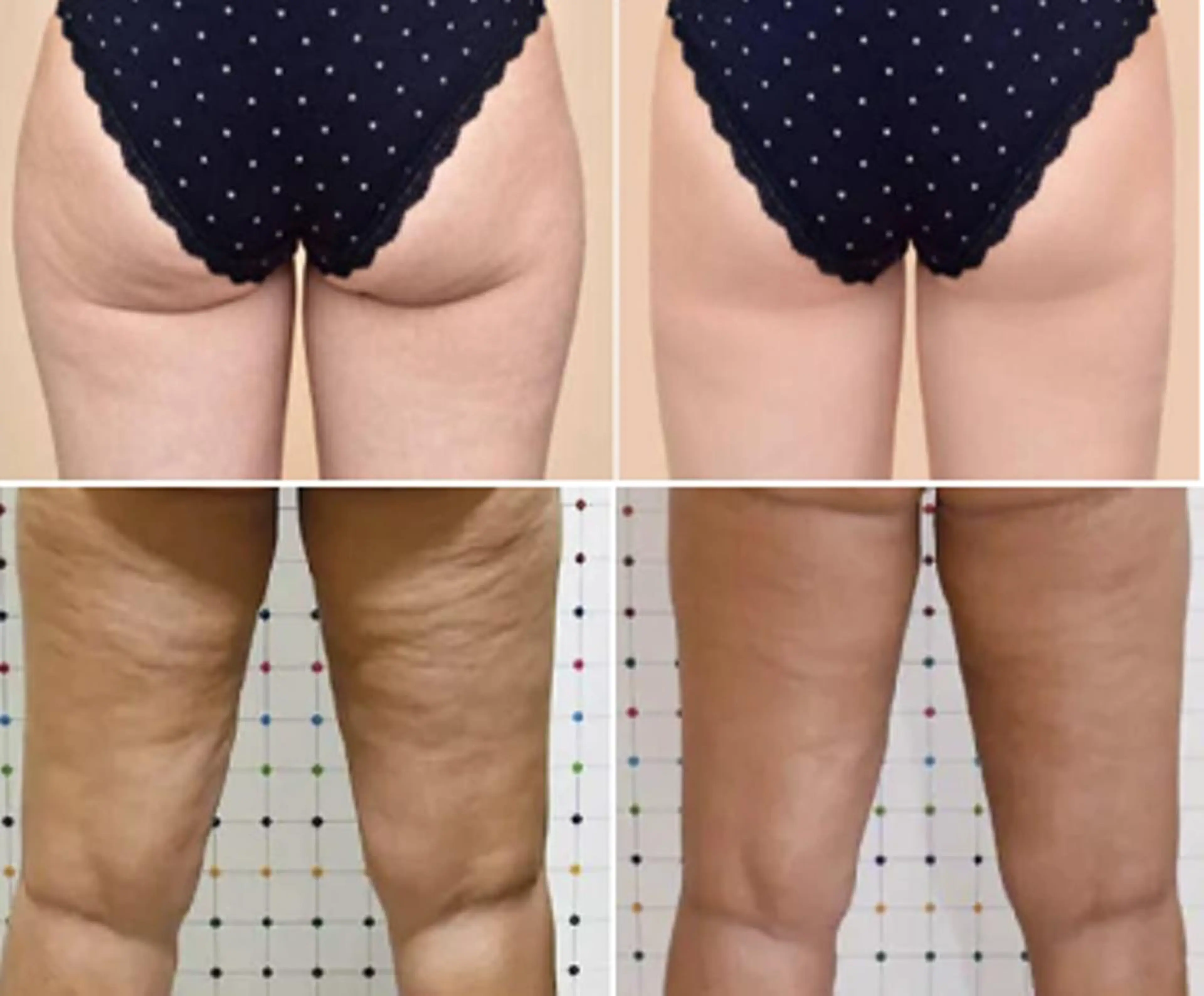 エステ 全身脱毛＆VIO脱毛 紹介率№1♪リナ♪のエステ・リラクイメージ