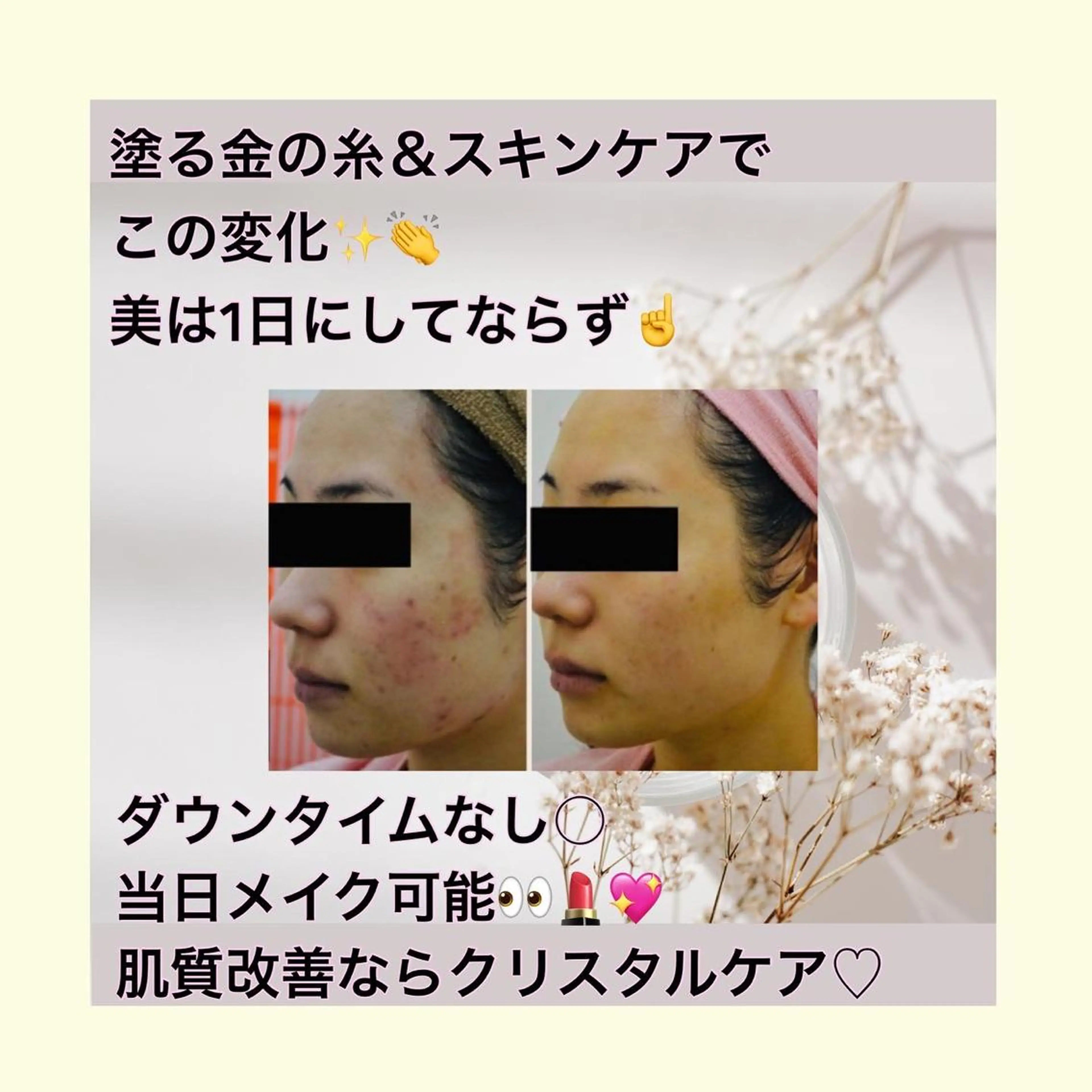 エステ HOME SALON linoのエステ・リラクイメージ