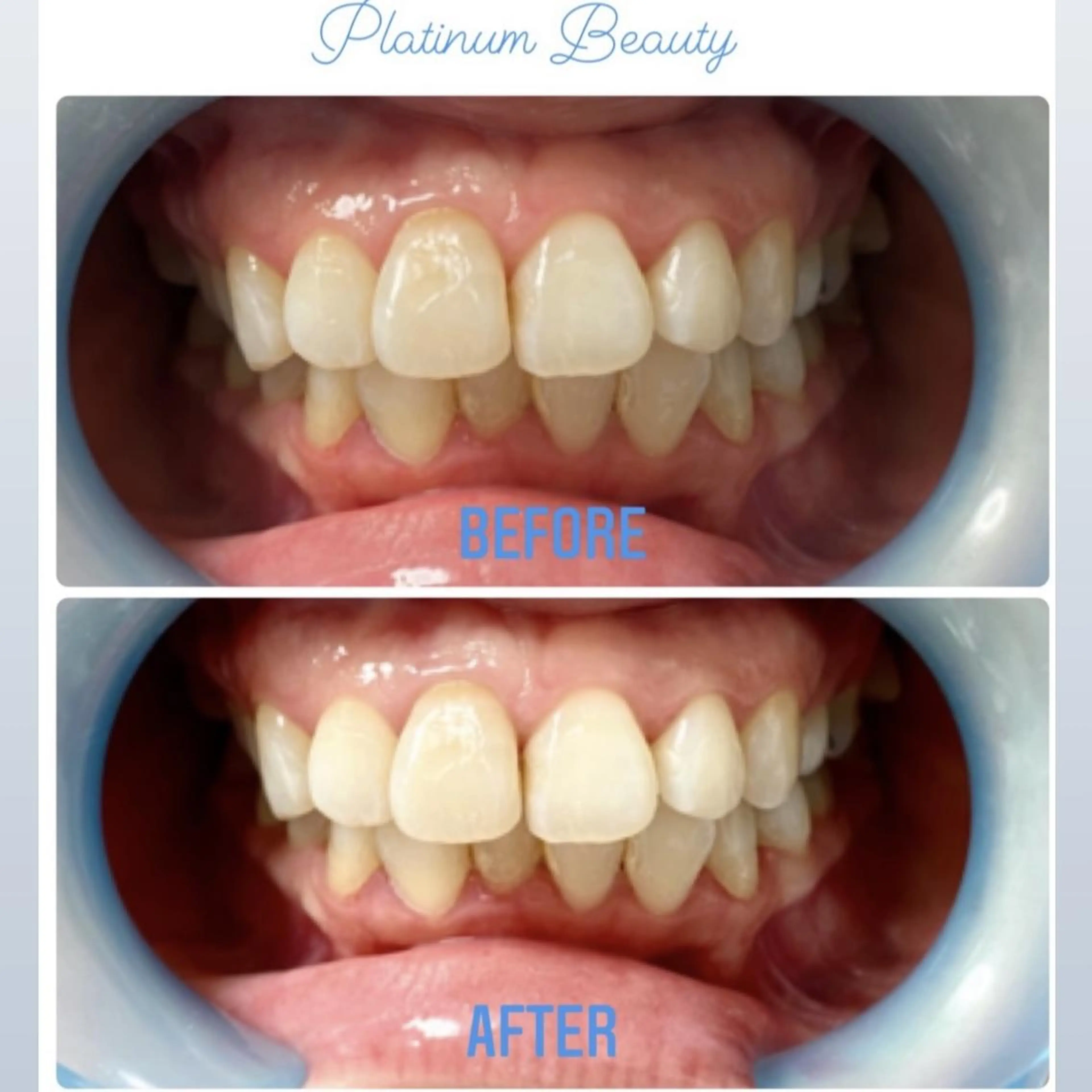 その他 プラティーヌ ボーテ【もものり】のその他イメージ