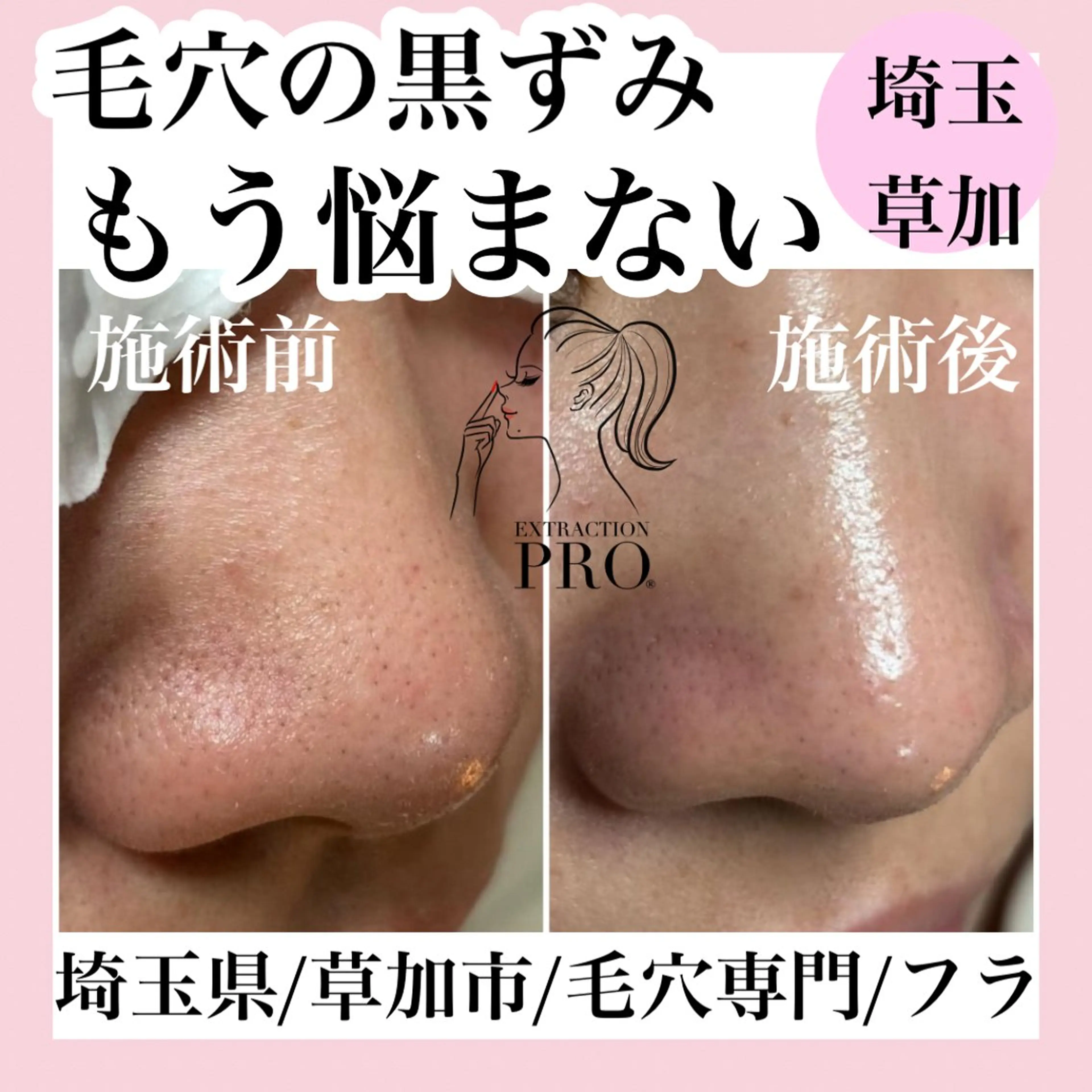 エステ 毛穴専門店hula 杉山智美のエステ・リラクイメージ