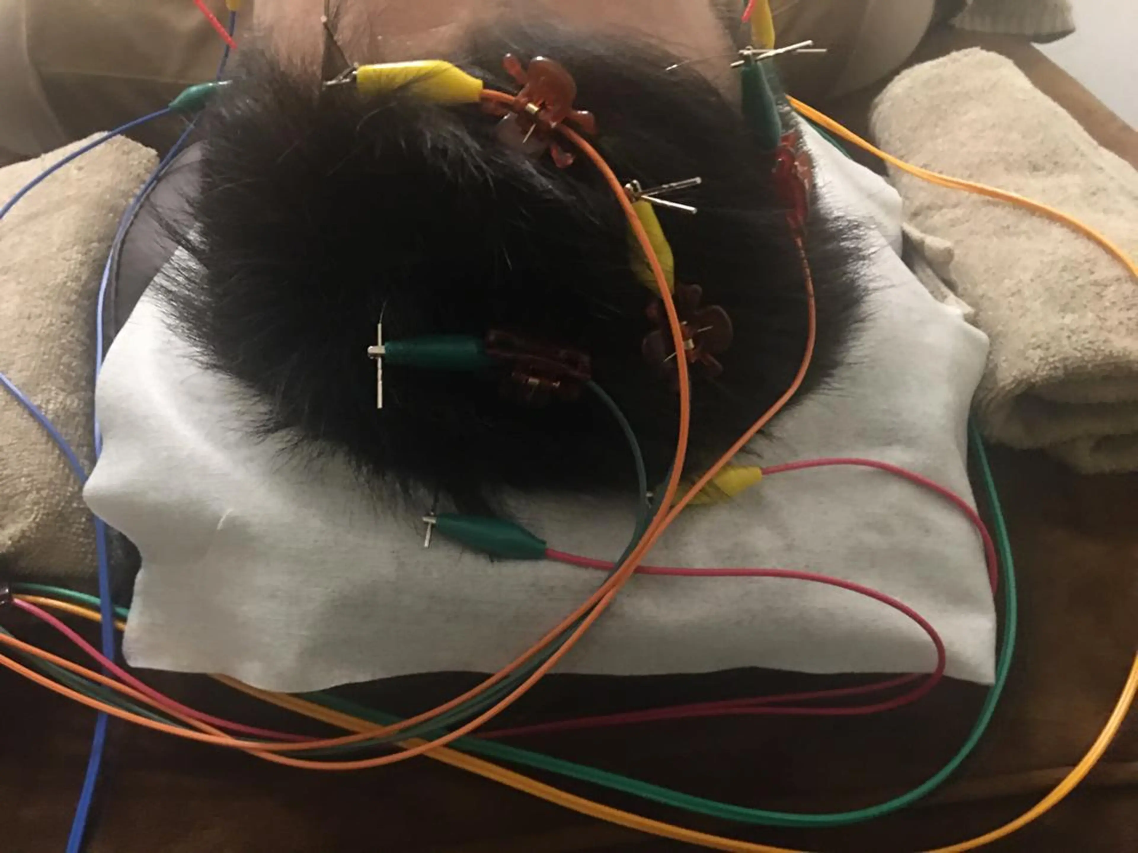 表参道鍼灸院K 美容鍼🔮ララピールのエステ・リラクイメージ