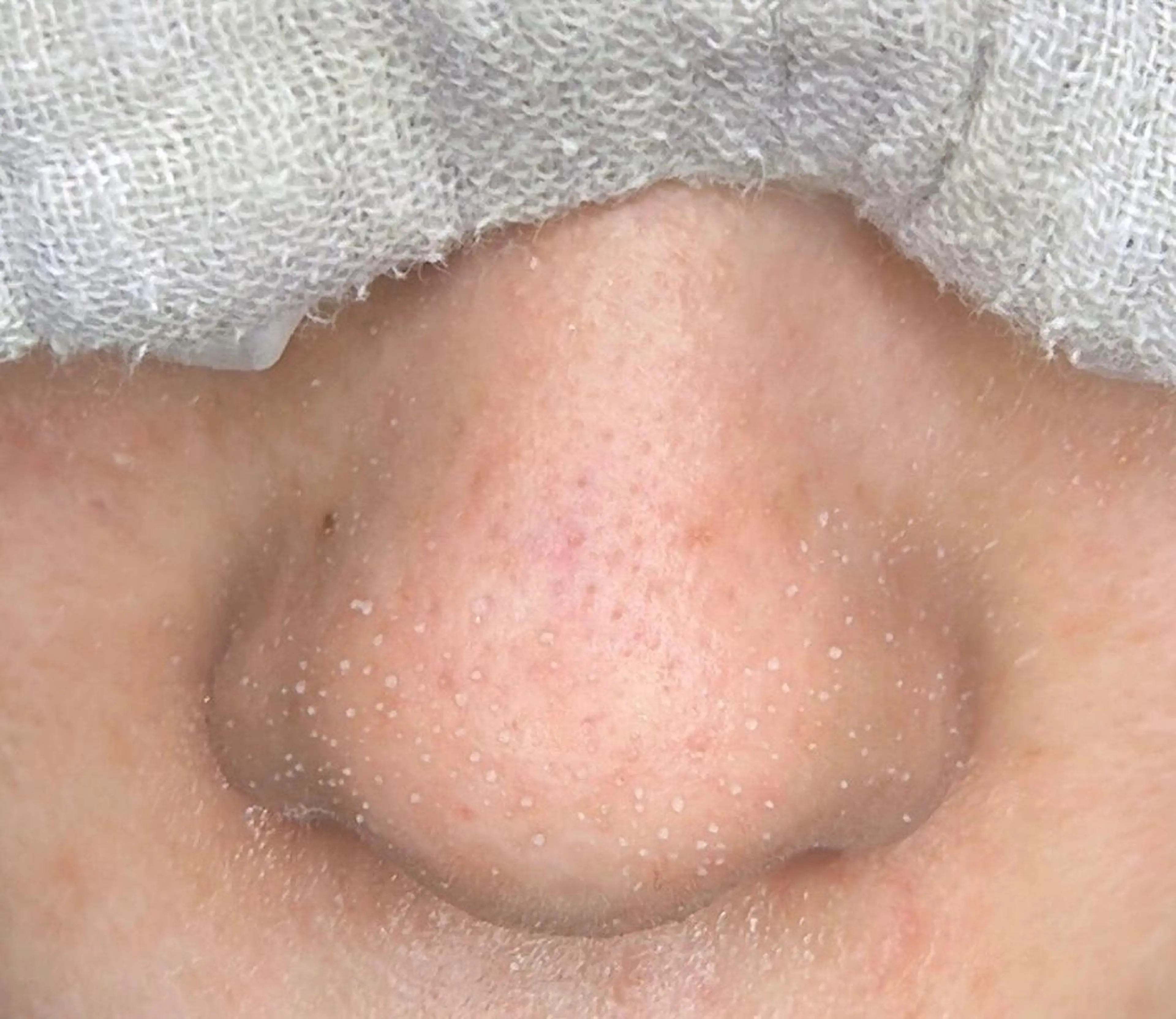 エステ private salon Koo所属・美肌サロン Kooのその他イメージ