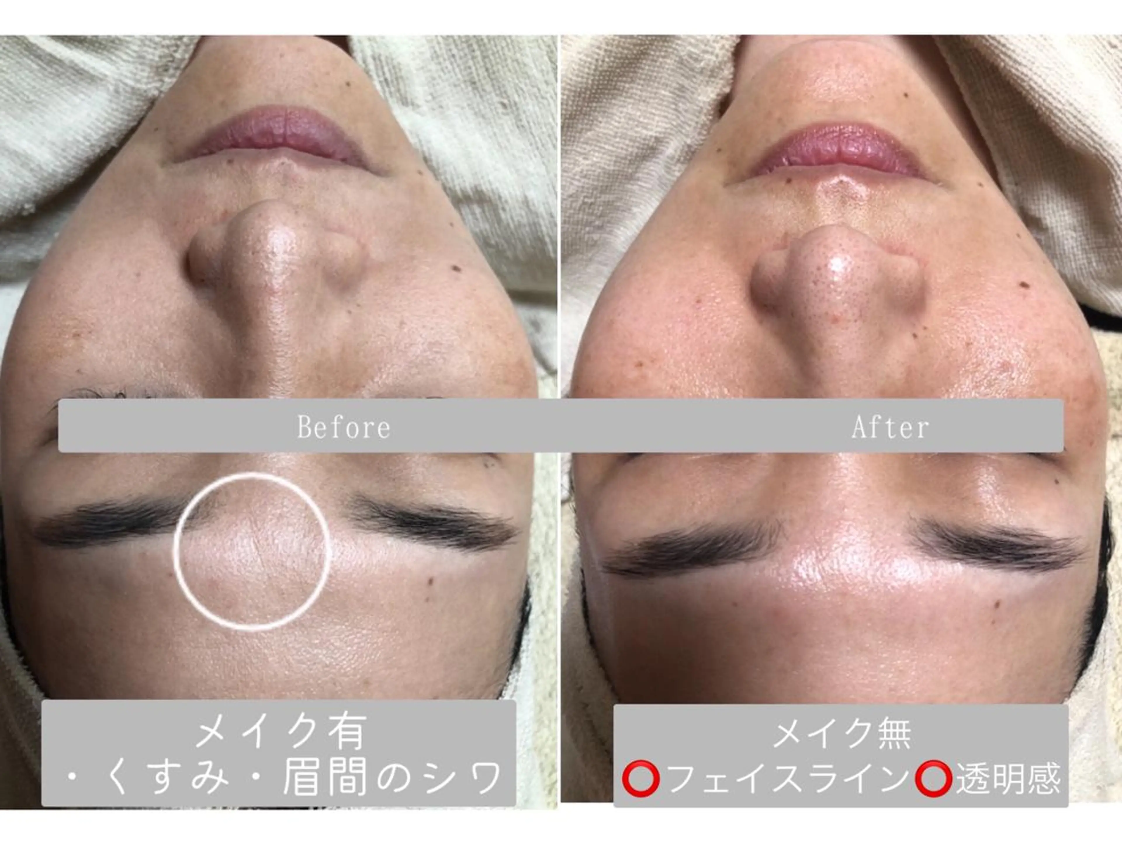 日頃の疲れを癒したい方必見❗️デコルテ付き泥フェイシャルエステマッサージ🍂期待以上、お値段以上のエステ内容です❗️の写真